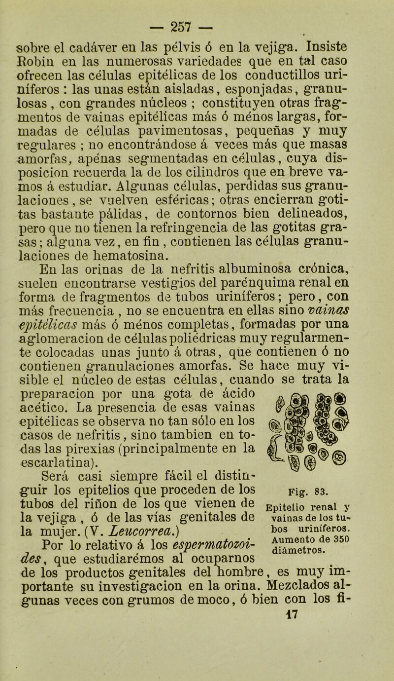 sobre el cadâver en las pélvis 6 en la vejig*a. Insiste Robin en las numerosas variedades que en tal caso ofrecen las células epitélicas de los conductillos uri- niferos : las unas estân aisladas, esponjadas, granu- losas , con grandes nûcleos ; constituyen otras frag*- mentos de vainas epitélicas mâs 6 ménos larg-as, for- madas de células pavimentosas, pequenas y muy reg*ulares ; no encontrândose â veces mâs que masas nmorfas, apénas seg-mentadas en células, cuya dis- posicion recuerda la de los cilindros que en breve va- mos â estudiar. Alg’unas células, perdidas sus granu- laciones , se viielven esféricas; otras encierran g*oti- tas bas tante pâlidas, de contornos bien delineados, pero que no tienen la refring*encia de las g*otitas gra- sas ; alg’una vez, en fin , contienen las células g’ranu- laciones de bematosina. En las orinas de la nefritis albuminosa crônica, suelen encontrarse vestigios del parénquima rénal en forma de fragmentes de tubos uriniferos ; pero, con mâs frecuencia , no se enciientra en ellas sino vainas epitélicas mâs ô ménos complétas, formadas por una aglomeracion de células poliédricas muy regularmen- te colocadas unas junte â otras, que contienen ô no contienen granulaciones amorfas. Se hace muy vi- sible el nùcleo de estas células, cuando se trata la preparacion por una g'ota de âcido acético. La presencia de esas vainas epitélicas se observa no tan sôlo en los casos de nefritis , sino tambien en to- das las pirexias (principalmente en la escarlatina). Serâ casi siempre fâcil el distin- g*uir los epitelios que proceden de los tubos del rinon de los que vienen de la vejiga , ô de las vias génitales de la mujer. (V. Leucorrea,) Por lo relativo â los espermatozoi- des, que estudiarémos al ocuparnos de los productos génitales del bombre, es muy im- portante su investigacion en la orina. Mezclados al- gunas veces con grumos de moco, ô bien con los fi- 17 Fig. 83. Epitelio rénal y vainas de los tu- bos uriniferos. Aumento de 350 diâmetros.