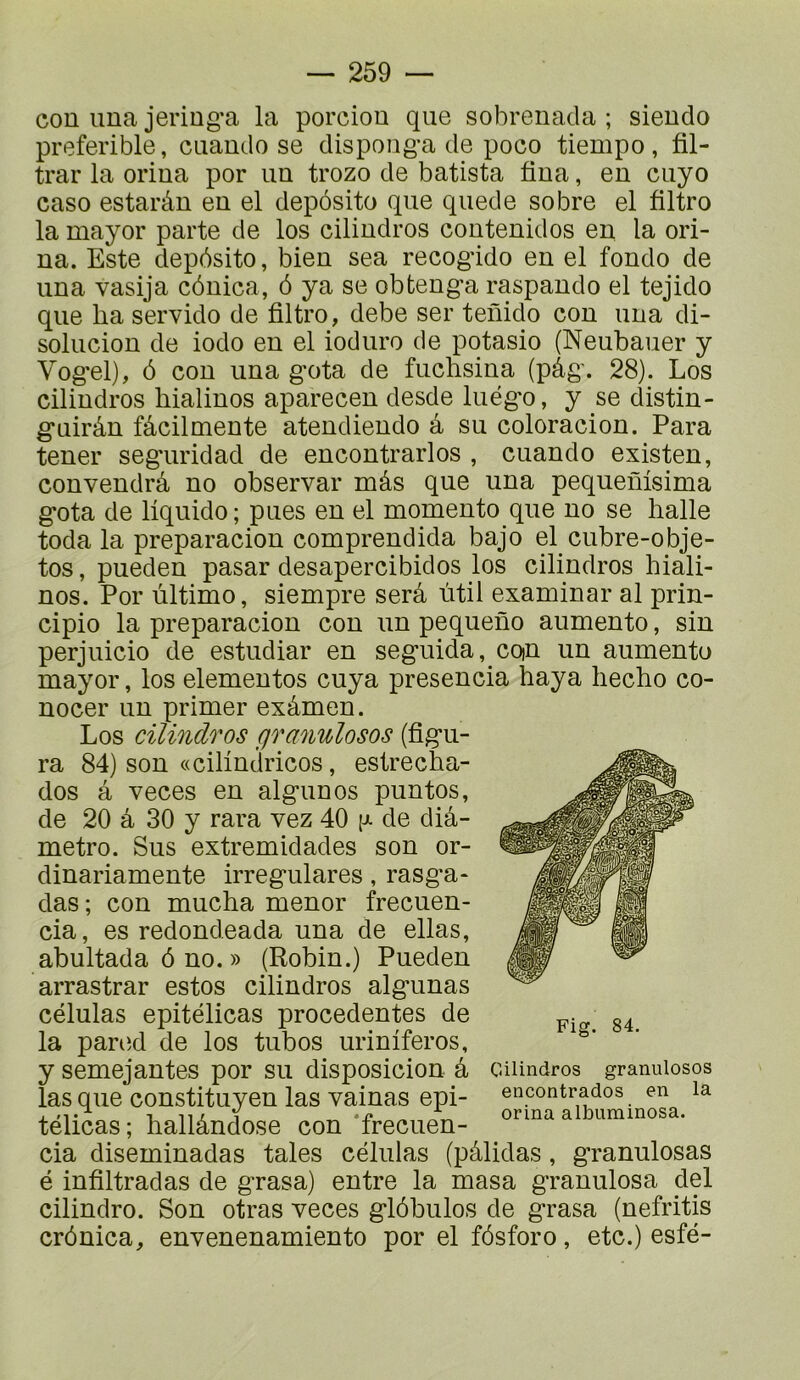 cou iina jering-a la porciou que sobreuada ; siendo preferible, cuaudo se dispong-a de poco tiempo, fil- trar la oriua por un trozo de batista fiua, en ciiyo caso estarâu eu el depôsito que quede sobre el filtro la mayor parte de los ciliudros couteuidos en la ori- ua. Este depôsito, bien sea recogddo eu el foudo de uua vasija côuica, ô ya se obtenga raspaudo el tejido que lia servido de filtro, debe ser tenido cou uua di- soluciou de iodo eu el iodiiro de potasio (Neubauer y Vog'el), ô cou uua g'ota de fuclisiua (pâg. 28). Los ciliudros liialiuos apareceu desde luégo, y se distin- guirâu fâcilmeute ateudieudo â su coloraciou. Para teuer seguridad de eucoutrarlos , cuaudo existeu, couveudrâ uo observai* mâs que uua pequeûisima gota de liquide ; pues eu el momeuto que uo se halle toda la preparaciou compreudida bajo el cubre-obje- tos, pueden pasar desapercibidos los ciliudros hiali- nos. Por ultime, siempre sera ûtil examinai* al prin- cipio la preparaciou cou un pequeno aumeuto, siu perjuicio de estudiar en seguida, coiu un aumeuto mayor, los elemeutos cuya presencia haya liecho co- uocer un primer exâmen. Los cilindros granulosos (figu- ra 84) sou «ciliudricos, estrecha- dos â veces eu alguuos puutos, de 20 â 30 y rara vez 40 (j- de dia- mètre. Sus extremidades sou or- dinariamente irregulares, rasga- das ; cou mucha mener frecuen- cia, es redondeada uua de ellas, abultada ô uo. » (Robin.) Pueden arrastrar estes cilindros algunas células epitélicas precedentes de la pared de los tubos uriniferos, y semejantes por su disposicion â las que constituyeu las vainas epi- télicas; hallândose cou ‘frecuen- cia disemiuadas taies células (pâlidas, granulosas é infiltradas de grasa) entre la masa grauulosa del cilindro. Sou otras veces glôbulos de grasa (nefritis crônica, euveueuamiento por el fôsforo, etc.) esfé- Fig. 84. Cilindros granulosos encontrados en la orina albuminosa.