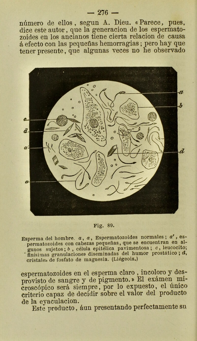 nùmero de elles, seg*un A. Dieu. «Parece, pues, diee este autor, que la ^eneracion de los espermato- zoides eu los ancianos tiene eierta relacion de causa â efecto cou las pequenas hemorrag*ias ; pero hay que tener présente, que algunas veees no he observado Fig. 89. EspGrrna del hombre. a, fl!, Esp6rmatozoid6s norniales î fl! , gs- perraatozoides con cabezas pequenas, que se encuentran en al- gunos sujetos;&, célula epitélica pavimentosa ; c, leucocito;  flnisimas granulaciones diseminadas del humor prostàtico ; d, cristales de fosfato de magnesia. (Liégeois.) espermatozoides en el esperma claro , incolore y des- provisto de sangre y de pig-mento.» El exâmen mi- croscôpico serâ siempre, por lo expuesto, el ùnico criterio capaz de decidir sobre el valor del producto de la eyaculacion. Este producto, âun presentandoperfectamentesu