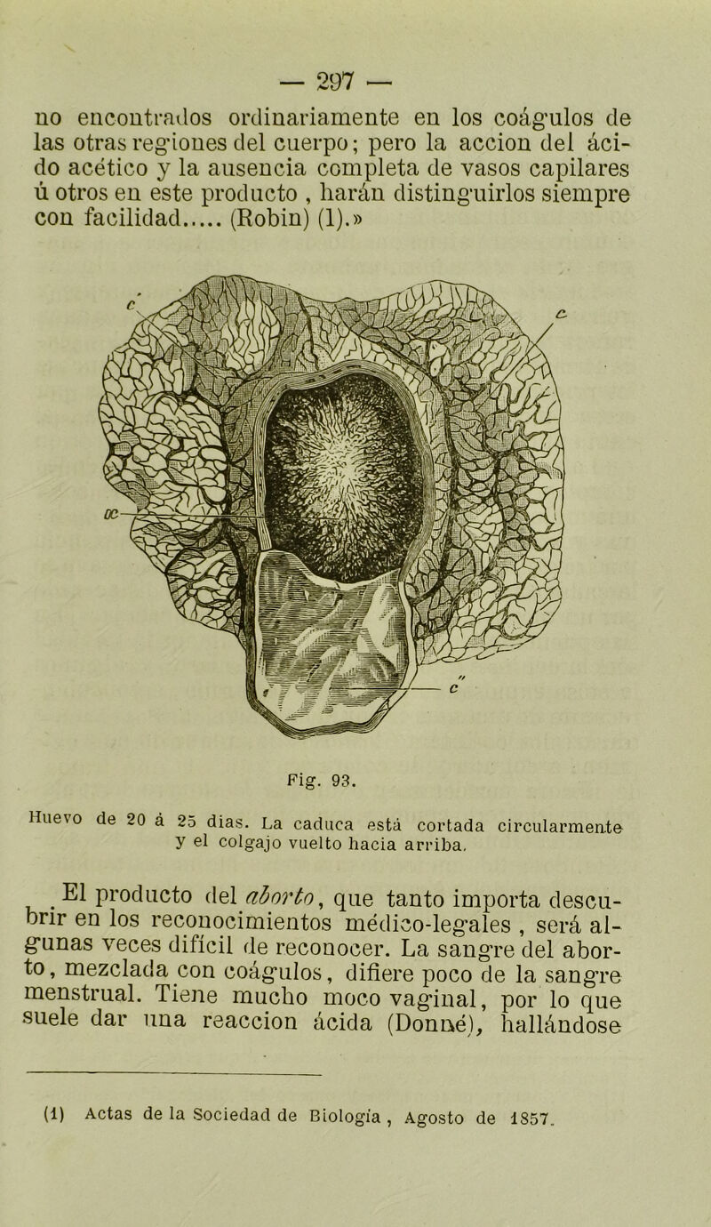 uo eiicoutrados ordinariamente en los coâg'ulos de las otras regnoues del ciierpo ; pero la accion del âci- do acético y la ausencia compléta de vasos capilares ù otros en este prodiicto , liaràn disting'uirlos siempre con facilidad (Robin) (1).» Fig. 93. Huevo de 20 à 25 dias. La caduca esta cortada circularmeate y el colgajo vuelto hacia arriba. El prodiicto i\^\ ahorto, que tanto importa descii- brir en los recouocimientos médico-leg’ales , serâ al- g*unas veces dificil de reconocer. La sangre del abor- to, mezclada con coâgulos, difiere poco de la sangre menstrual. Tiene mucbo moco vaginal, por lo que suele dar una reaccion âcida (Donné), hallândose (1) Actas de la Sociedad de Biologia , Agosto de 1857