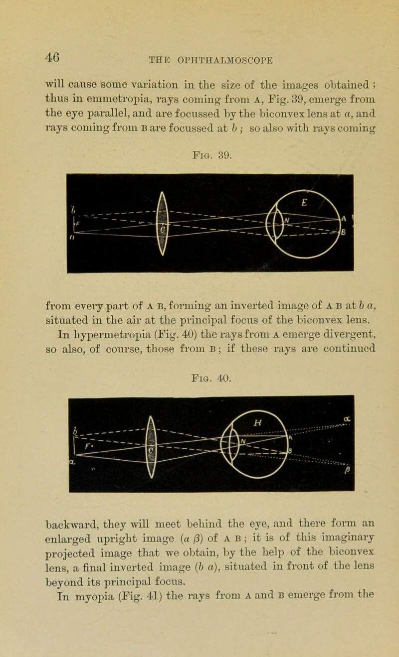 will cause some variation in the size of the images obtained ; thus in emmetropia, rajs coming from A, Fig. 39, emerge from the eye parallel, and are focussed by the biconvex lens at a, and rays coming from b are focussed at b ; so also with rays coming Fig. 39. from every part of A B, forming an inverted image of A B at b a, situated in the air at the principal focus of the biconvex lens. In hypermetropia (Fig. 40) the rays from A emerge divergent, so also, of course, those from B; if these rays are continued Fig. 40. backward, they will meet behind the eye, and there form an enlarged upright image (a /3) of A b ; it is of this imaginary projected image that we obtain, by the help of the biconvex lens, a final inverted image (b a), situated in front of the lens beyond its principal focus. In myopia (Fig. 41) the rays from A and B emerge from the