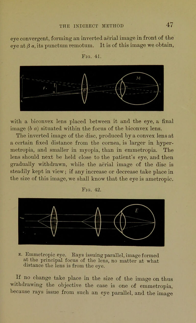 eye convergent, forming an inverted aerial image in front of the eye at /3 a, its pnnctum remotum. It is of this image we obtain, Fig. 41. with a biconvex lens placed between it and the eye, a final image (b a) situated within the focus of the biconvex lens. The inverted image of the disc, produced by a convex lens at a certain fixed distance from the cornea, is larger in hyper- metropia, and smaller in myopia, than in emmetropia. The lens should next be held close to the patient’s eye, and then gradually withdrawn, while the aerial image of the disc is steadily kept in view; if any increase or decrease take place in the size of this image, we shall know that the eye is ametropic. Fig. 42. e. Emmetropic eye. Kays issuing parallel, image formed at the principal focus of the lens, no matter at what distance the lens is from the eye. If no change take place in the size of the image on thus withdrawing the objective the case is one of emmetropia, because rays issue from such an eye parallel, and the image