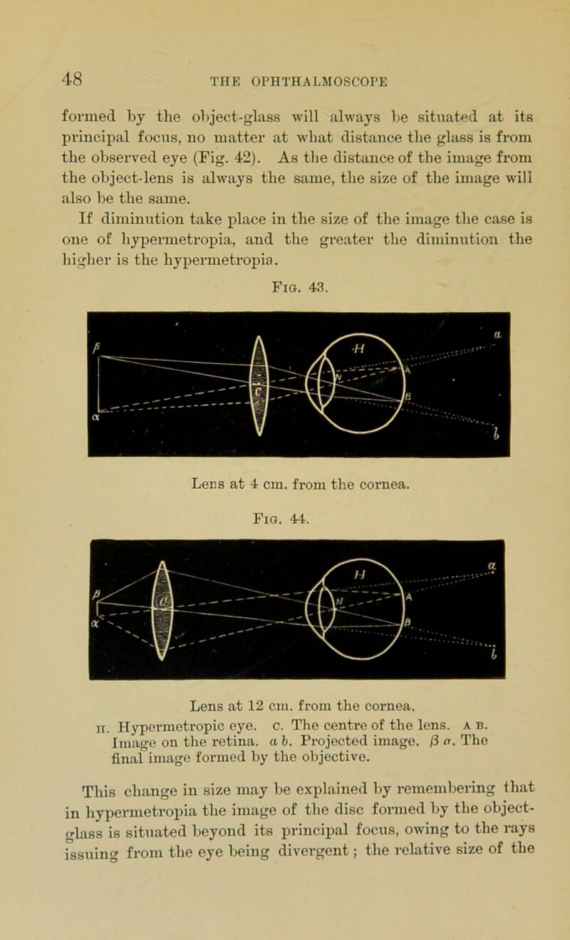 formed by the object-glass will always be situated at its principal focus, no matter at what distance the glass is from the observed eye (Fig. 42). As the distance of the image from the object-lens is always the same, the size of the image will also be the same. If diminution take place in the size of the image the case is one of hypermetropia, and the greater the diminution the higher is the hypermetropia. Fig. 43. Lens at 4 cm. from the cornea. Fig. 44. Lens at 12 cm. from the cornea. ii. Hypermetropic eye. c. The centre of the lens, a b. Image on the retina, a b. Projected image. /3 a. The final image formed by the objective. This change in size may be explained by remembering that in hypermetropia the image of the disc formed by the object- glass is situated beyond its principal focus, owing to the rays issuing from the eye being divergent; the relative size of the