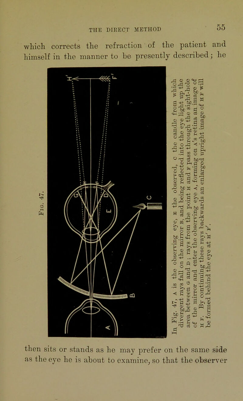 Fig. 47. which corrects the refraction of the patient and himself in the manner to be presently described; he then sits or stands as he may prefer on the same side as the eye he is about to examine, so that the observer