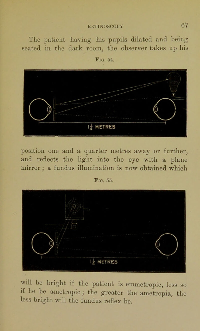 The patient having his pupils dilated and being seated in the dark room, the observer takes up his Fig. 54. position one and a quarter metres away or further, and reflects the light into the eye with a plane mirror; a fundus illumination is now obtained which Fig. 53. will be bright if the patient is emmetropic, less so if he be ametropic; the greater the ametropia, the less bright will the fundus reflex be.