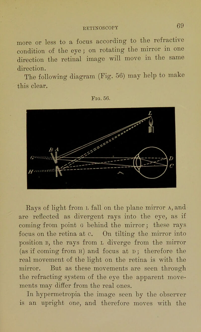 more or less to a focus according to tlie refractive condition of the eye; on rotating the mirror in one direction the retinal image will move in the same direction. The following diagram (Fig. 56) may help to make this clear. Fig. 56. Rays of light from L fall on the plane mirror A, and are reflected as divergent rays into the eye, as if coming from point g behind the mirror; these rays focus on the retina at c. On tilting the mirror into position b, the rays from l diverge from the mirror (as if coming from h) and focus at D; therefore the real movement of the light on the retina is with the mirror. But as these movements are seen through the refracting system of the eye the apparent move- ments may differ from the real ones. In hypermetropia the image seen by the observer is an upright one, and therefore moves with the