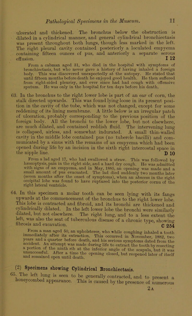ulcerated and thickened. The bronchus below the obstruction is dilated in a cylindrical manner, and general cylindrical bronchiectasis was present throughout both lungs, though less marked in the left. The right pleural cavity contained posteriorly a loculated empyema containing fifteen ounces of pus, and anteriorly a separate serous effusion. I 12 Prom a cabman aged 31, who died in the hospital with symptoms of bronchiectasis, but who never gave a history of having inhaled a foreign body. This was discovered unexpectedly at the autopsy. He stated that imtil fifteen months before death he enjoyed good health. He then suffered from right-sided pleurisy, and ever since had had coirgh with offensive spixtum. He was only in the hospital for ten days before his death. 63. In the bronchus to the right lower lobe is part of an ear of corn, the stalk directed upwards. This was found lying loose in its present posi- tion in the cavity of the tube, which was not changed, except for some reddening of its fining membrane. A little below is an irregular patch of ulceration, probably corresponding to the previous position of the foreign body. All the bronchi to the lower lobe, but not elsewhere, are much dilated, and contained reddish fluid. The intervening lung is collapsed, airless, and somewhat indurated. A small thin-walled cavity in the middle lobe contained pus (no tubercle bacilli) and com- municated by a sinus with the remains of an empyema which had been opened during fife by an incision in the sixth right intercostal space in the nipple fine. D 10 Prom a lad aged 17, who had swallowed a straw. This was followed by hiEmoptysis, pain in the right side, and a hard dry cough. He was admitted with signs of an emj)yema, and in May, 1885, an opening was made and a small amoimt of pus evacuated. The lad died suddenly two months later (seven months after the onset of symptoms), when an abscess in the right occipital lobe was found to have ruptured into the posterior cornu of the right lateral ventricle. 64. In this specimen a molar tooth can be seen lying with its fangs upwards at the commencement of the bronchus to the right lower lobe. This lobe is contracted and fibroid, and its bronchi are thickened and cylindrically dilated. In the left lower lobe the bronchi were similarly dilated, but not elsewhere. The right lung, and to a less extent the left, was also the seat of tuberculous disease of a chronic type, showing fibrosis and excavation. P 9 • ^ 50, an upholsterer, who while coughing inhaled a tooth immediately after its extraction. This occurred in November, 1882 two years and a quarter before death, and his serious symptoms dated from the accident. An attempt was made during life to extract the tooth by resectinff a portion of the ninth rib at the inferior angle of the scapula, but it was unsuccessful After a time the opening closed, but reopened later of itself and remained open until death. (2) Specimens showing Cylindrical Bronchiectasis. 65 The left lung is seen to be generally contracted, and to present a honeycombed appearance. This is caused by the presence of numerous 2a