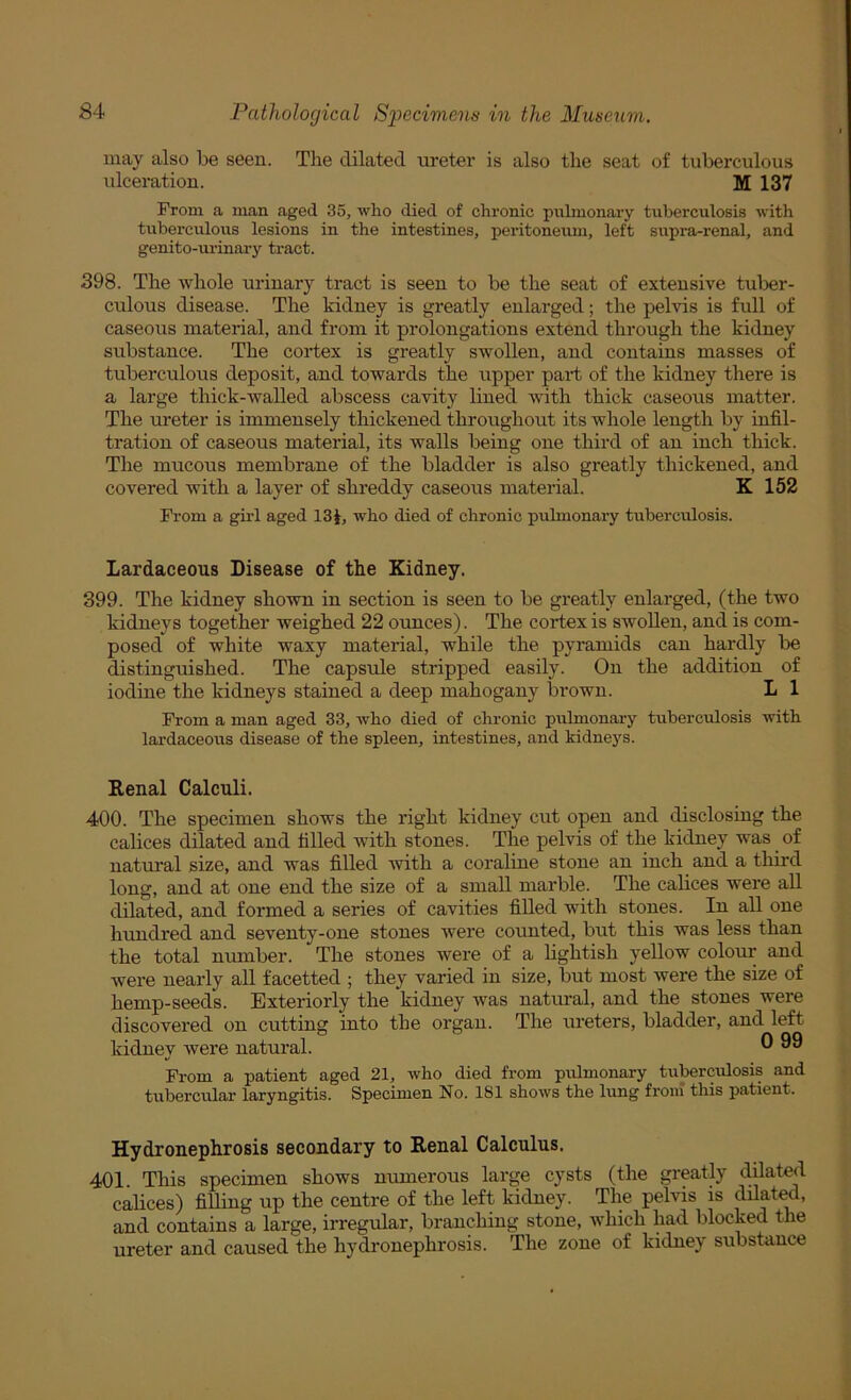 may also be seen. The dilated ureter is also the seat of tuberculous ulceration. M 137 From a man aged 35, who died of chronic pulmonary tuberculosis with tuberculous lesions in the intestines, peritoneum, left supra-renal, and genito-m’inary tract. 398. The whole urinary tract is seen to be the seat of extensive tuber- culous disease. The kidney is greatly enlarged; the pelvis is full of caseous material, and from it prolongations extend through the kidney substance. The cortex is greatly swollen, and contains masses of tuberculous deposit, and towards the upper part of the kidney there is a large thick-walled abscess cavity lined Avith thick caseous matter. The ureter is immensely thickened throughout its whole length by infil- tration of caseous material, its walls being one third of an inch thick. The mucous membrane of the bladder is also greatly thickened, and covered with a layer of shreddy caseous material. K 152 From a girl aged 13i, who died of chronic pulmonary tuberculosis. Lardaceous Disease of the Kidney. 399. The kidney shown in section is seen to be greatly enlarged, (the two kidneys together weighed 22 ounces). The cortex is swollen, and is com- posed of white waxy material, while the pyramids can hardly be distinguished. The capsule stripped easily. On the addition of iodine the kidneys stained a deep mahogany brown. L 1 From a man aged 33, who died of chronic pulmonary tuberculosis with lardaceous disease of the spleen, intestines, and kidneys. Renal Calculi. 400. The specimen shows the right kidney cut open and disclosing the calices dilated and filled Avith stones. The pelvis of the kidney was of natui’al size, and was filled Avith a coraline stone an inch and a tliird long, and at one end the size of a small marble. The calices Avere all dilated, and formed a series of cavities filled with stones. In all one hundred and seventy-one stones Avere counted, but this was less than the total number. The stones were of a hghtish yeUow colour and were nearly all facetted ; they varied in size, but most were the size of hemp-seeds. Exteriorly the kidney Avas natural, and the stones were discovered on cutting into the organ. The ureters, bladder, and left kidney were natural. ® From a patient aged 21, who died from pulmonary tiiberculosis and tubercular laryngitis. Specimen No. 181 shoAvs the lung from tliis patient. Hydronephrosis secondary to Renal Calculus. 401. This specimen shows numerous large cysts (the greatly dilated calices) filling up the centre of the left kidney. The pelvis is ^ated, and contains a large, irregular, branching stone, Avhich had blocked the ureter and caused the hydi-onephrosis. The zone of kidney substance