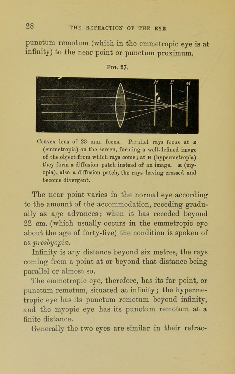 punctum rernotum (which in the emmetropic eye is at infinity) to the near point or punctum proximum. Fiu. 27. Convex lens of 23 mm. focus. Pariillel rays focus at b (emmetropia) on the screen, forming a well-defined image of the object from which rays come; at H (hypermetropia) they form a diffusion patch instead of an image. M (my- opia), also a diffusion patch, the rays having crossed and become divergent. The near point varies in the normal eye according to the amount of the accommodation, receding gradu- ally as age advances; when it has receded beyond 22 cm. (which usually occurs in the emmetropic eye about the age of forty-five) the condition is spoken of as presbyopia. Infinity is any distance beyond six metres, the rays coming from a point at or beyond that distance being parallel or almost so. The emmetropic eye, therefore, has its far point, or punctum rernotum, situated at infinity; the hyperme- tropic eye has its punctum rernotum beyond infinity, and the myopic eye has its punctum rernotum at a finite distance. Generally the two eyes are similar in their refrac-