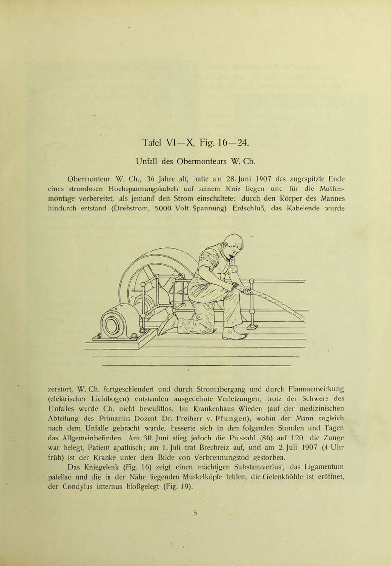 Tafel VI-X, Fig. 16-24. Unfall des Obermonteurs W. Ch. Obermonteur W. Ch., 36 Jahre alt, hatte am 28. Juni 1907 das zugespitzte Ende eines stromlosen Hochspannungskabels auf seinem Knie liegen und für die Muffen- montage vorbereitet, als jemand den Strom einschaltete: durch den Körper des Mannes hindurch entstand (Drehstrom, 5000 Volt Spannung) Erdschluß, das Kabelende wurde zerstört, W. Ch. fortgeschleudert und durch Stromübergang und durch Flammenwirkung (elektrischer Lichtbogen) entstanden ausgedehnte Verletzungen; trotz der Schwere des Unfalles wurde Ch. nicht bewußtlos. Im Krankenhaus Wieden (auf der medizinischen Abteilung des Primarius Dozent Dr. Freiherr v. Pfungen), wohin der Mann sogleich nach dem Unfälle gebracht wurde, besserte sich in den folgenden Stunden und Tagen das Allgemeinbefinden. Am 30. Juni stieg jedoch die Pulszahl (86) auf 120, die Zunge war belegt, Patient apathisch; am 1. Juli trat Brechreiz auf, und am 2. Juli 1907 (4 Uhr früh) ist der Kranke unter dem Bilde von Verbrennungstod gestorben. Das Kniegelenk (Fig. 16) zeigt einen mächtigen Substanzverlust, das Ligamentum patellae und die in der Nähe liegenden Muskelköpfe fehlen, die Qelenkhöhle ist eröffnet, der Condylus internus bloßgelegt (Fig. 19).