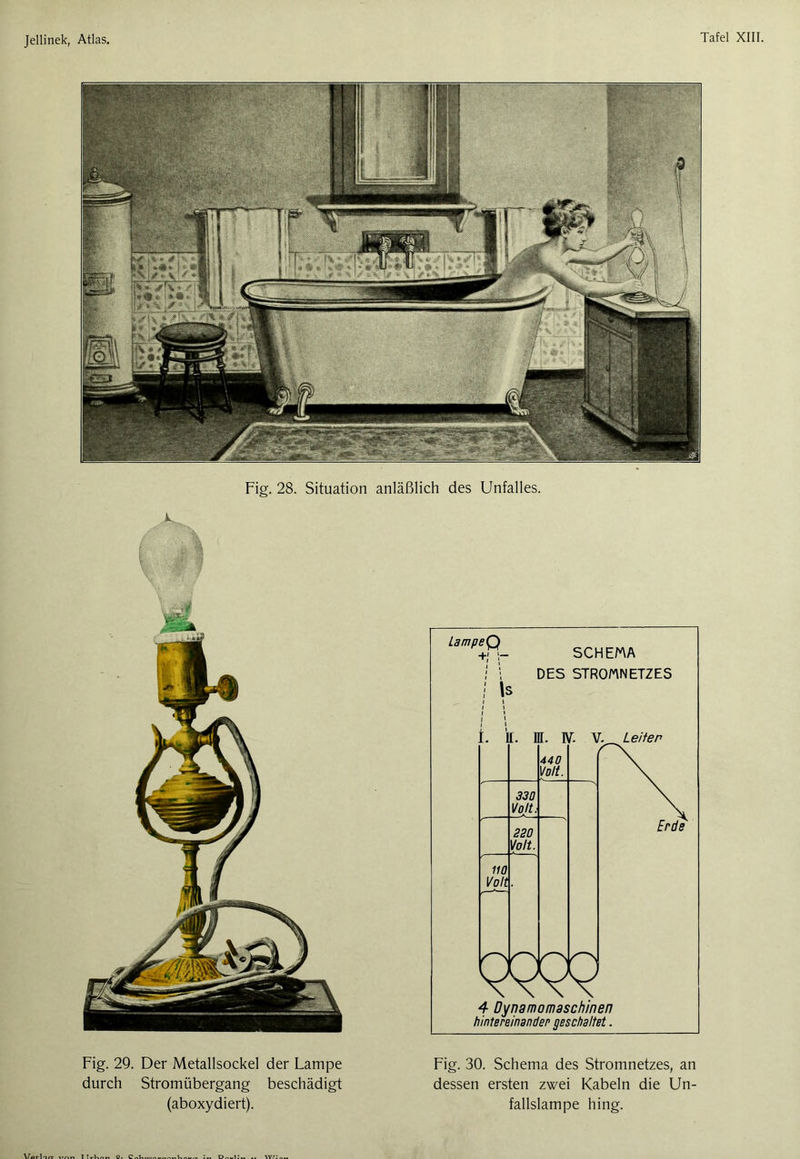 Tafel Fig. 28. Situation anläßlich des Unfalles. LampeQ +M- SCHEMA I 1 DES STROMNETZES ! ls I I I l 1 1 IL. nr. N. V. Leiter 440 Volt. 330 Volt. 330 Volt. 110 Volt Erde \VVY 4 Dynamomaschinen hintereinander geschaltet. Fig. 29. Der Metallsockel der Lampe durch Stromübergang beschädigt (aboxydiert). Fig. 30. Schema des Stromnetzes, an dessen ersten zwei Kabeln die Un- fallslampe hing.