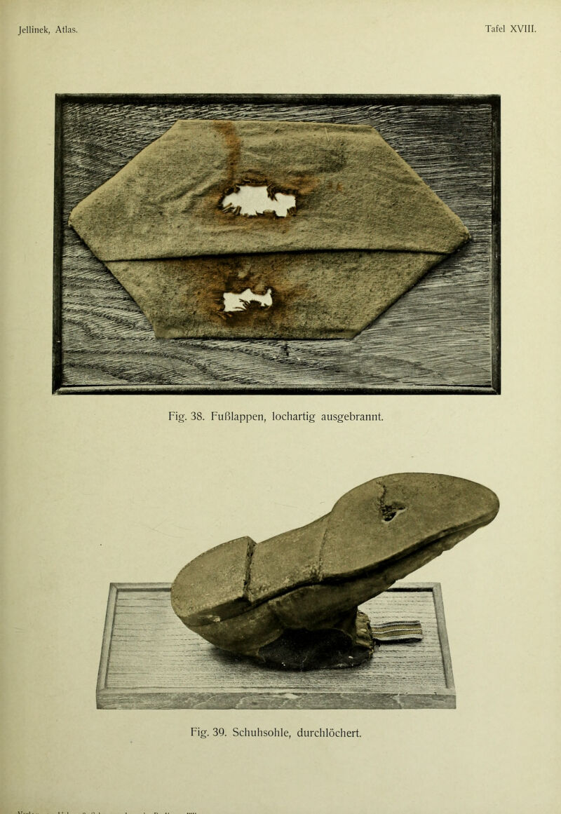 Fig. 38. Fußlappen, lochartig ausgebrannt.