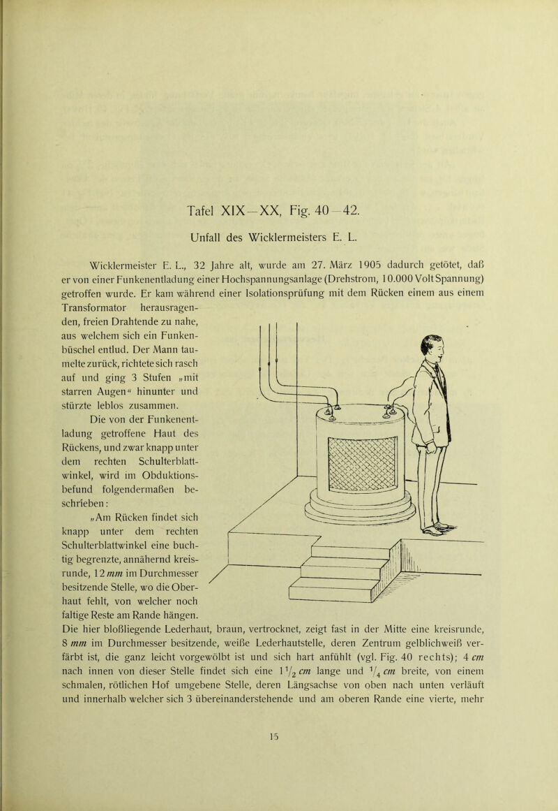 Unfall des Wicklermeisters E. L. Wicklermeister E. L., 32 Jahre alt, wurde am 27. März 1905 dadurch getötet, daß er von einer Funkenentladung einer Hochspannungsanlage (Drehstrom, 10.000 Volt Spannung) getroffen wurde. Er kam während einer Isolationsprüfung mit dem Rücken einem aus einem Transformator herausragen- den, freien Drahtende zu nahe, aus welchem sich ein Funken- büschel entlud. Der Mann tau- melte zurück, richtete sich rasch auf und ging 3 Stufen „mit starren Augen“ hinunter und stürzte leblos zusammen. Die von der Funkenent- ladung getroffene Haut des Rückens, und zwar knapp unter dem rechten Schulterblatt- winkel, wird im Obduktions- befund folgendermaßen be- schrieben : „Am Rücken findet sich knapp unter dem rechten Schulterblattwinkel eine buch- tig begrenzte, annähernd kreis- runde, 12 mm im Durchmesser besitzende Stelle, wo die Ober- haut fehlt, von welcher noch faltige Reste am Rande hängen. Die hier bloßliegende Lederhaut, braun, vertrocknet, zeigt fast in der Mitte eine kreisrunde, 8 mm im Durchmesser besitzende, weiße Lederhautstelle, deren Zentrum gelblichweiß ver- färbt ist, die ganz leicht vorgewölbt ist und sich hart anfühlt (vgl. Fig. 40 rechts); 4 cm nach innen von dieser Stelle findet sich eine 1 Y2 cm lange und Y4 cm breite, von einem schmalen, rötlichen Hof umgebene Stelle, deren Längsachse von oben nach unten verläuft und innerhalb welcher sich 3 übereinanderstehende und am oberen Rande eine vierte, mehr 15