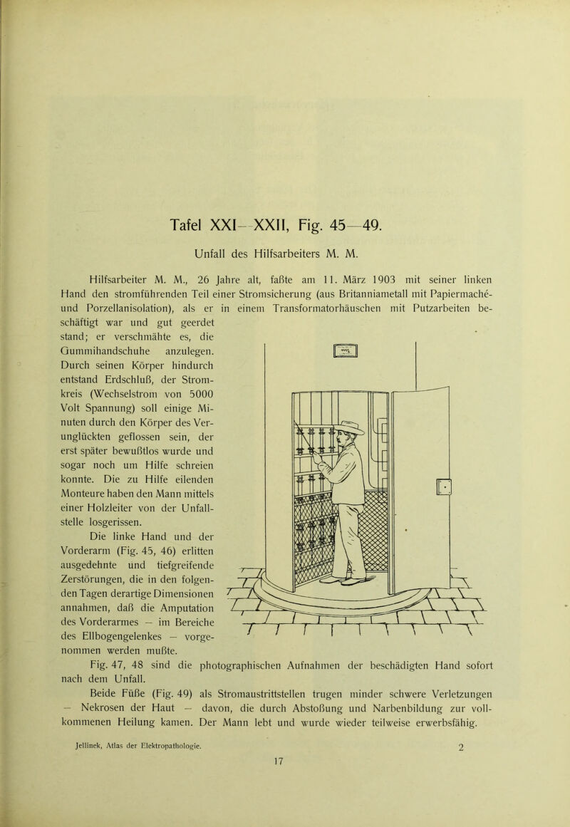 Tafel XXI- XXII, Fig. 45—49. Unfall des Hilfsarbeiters M. M. Hilfsarbeiter M. M.; 26 Jahre alt, faßte am 11. März 1903 mit seiner linken Hand den stromführenden Teil einer Stromsicherung (aus Britanniametall mit Papiermache- und Porzellanisolation), als er in einem Transformatorhäuschen mit Putzarbeiten be- schäftigt war und gut geerdet stand; er verschmähte es, die Gummihandschuhe anzulegen. Durch seinen Körper hindurch entstand Erdschluß, der Strom- kreis (Wechselstrom von 5000 Volt Spannung) soll einige Mi- nuten durch den Körper des Ver- unglückten geflossen sein, der erst später bewußtlos wurde und sogar noch um Hilfe schreien konnte. Die zu Hilfe eilenden Monteure haben den Mann mittels einer Holzleiter von der Unfall- stelle losgerissen. Die linke Hand und der Vorderarm (Fig. 45, 46) erlitten ausgedehnte und tiefgreifende Zerstörungen, die in den folgen- den Tagen derartige Dimensionen annahmen, daß die Amputation des Vorderarmes — im Bereiche des Ellbogengelenkes — vorge- nommen werden mußte. Fig. 47, 48 sind die photographischen Aufnahmen der beschädigten Hand sofort nach dem Unfall. Beide Füße (Fig. 49) als Stromaustrittstellen trugen minder schwere Verletzungen — Nekrosen der Haut — davon, die durch Abstoßung und Narbenbildung zur voll- kommenen Heilung kamen. Der Mann lebt und wurde wieder teilweise erwerbsfähig. Jellinek, Atlas der Elektropathologie.