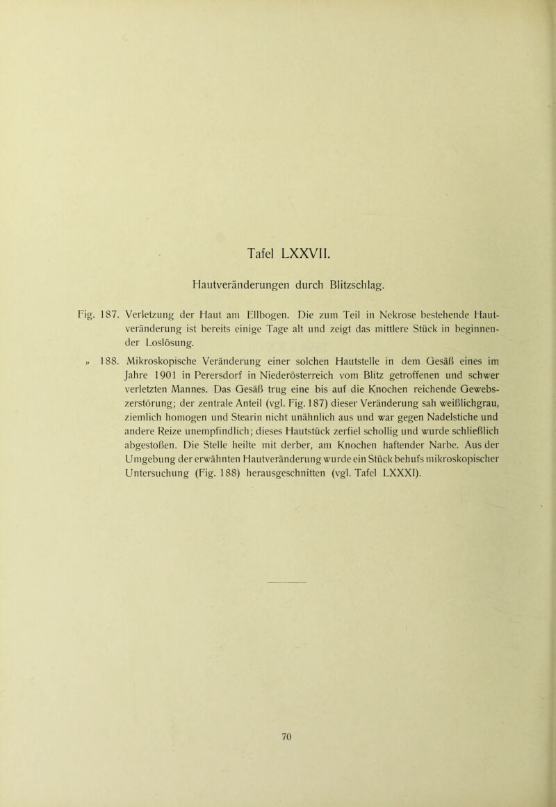 Hautveränderungen durch Blitzschlag. Fig. 187. Verletzung der Haut am Ellbogen. Die zum Teil in Nekrose bestehende Haut- veränderung ist bereits einige Tage alt und zeigt das mittlere Stück in beginnen- der Loslösung. ii 188. Mikroskopische Veränderung einer solchen Hautstelle in dem Gesäß eines im Jahre 1901 in Perersdorf in Niederösterreich vom Blitz getroffenen und schwer verletzten Mannes. Das Gesäß trug eine bis auf die Knochen reichende Gewebs- zerstörung; der zentrale Anteil (vgl. Fig. 187) dieser Veränderung sah weißlichgrau, ziemlich homogen und Stearin nicht unähnlich aus und war gegen Nadelstiche und andere Reize unempfindlich; dieses Hautstück zerfiel schollig und wurde schließlich abgestoßen. Die Stelle heilte mit derber, am Knochen haftender Narbe. Aus der Umgebung der erwähnten Hautveränderung wurde ein Stück behufs mikroskopischer Untersuchung (Fig. 188) herausgeschnitten (vgl. Tafel LXXXI).