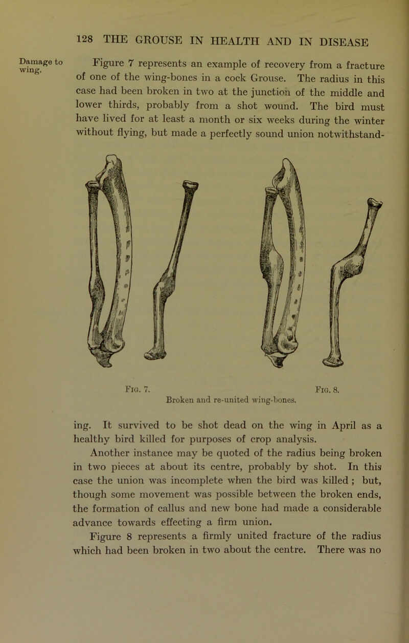 Damage to wing. 128 THE GROUSE IN HEALTH AND IN DISEASE Figure 7 represents an example of recovery from a fracture of one of the wing-bones in a cock Grouse. The radius in this case had been broken in two at the junction of the middle and lower thirds, probably from a shot wound. The bird must have lived for at least a month or six weeks during the winter without flying, but made a perfectly sound union notwithstand- Fig. 7. Broken and re-united wing-bones. Fig. 8. ing. It survived to be shot dead on the wing in April as a healthy bird killed for purposes of crop analysis. Another instance may be quoted of the radius being broken in two pieces at about its centre, probably by shot. In this case the union was incomplete when the bird was killed ; but, though some movement was possible between the broken ends, the formation of callus and new bone had made a considerable advance towards effecting a firm union. Figure 8 represents a firmly united fracture of the radius which had been broken in two about the centre. There was no