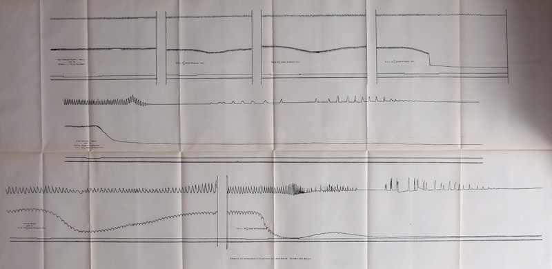 -VS^VW^'VY'rn'V’^r: MAMJ\MM lIjIL J JlUiJJjUUjUlX. J It H- EFFECTS OF INTRAVENOUS INJECTION OF LEAD SALTS OLIVER AND BOLAM