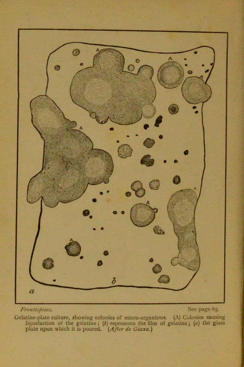 Frontispiece. See page 65. Gelatine-plate culture, showing colonies of micro-organisms. (A) Colonies causing liquefaction of the gelatine; (6) represents the film of gelatine; (a) the glass plate upon which it is poured. {After de Giaxa.)