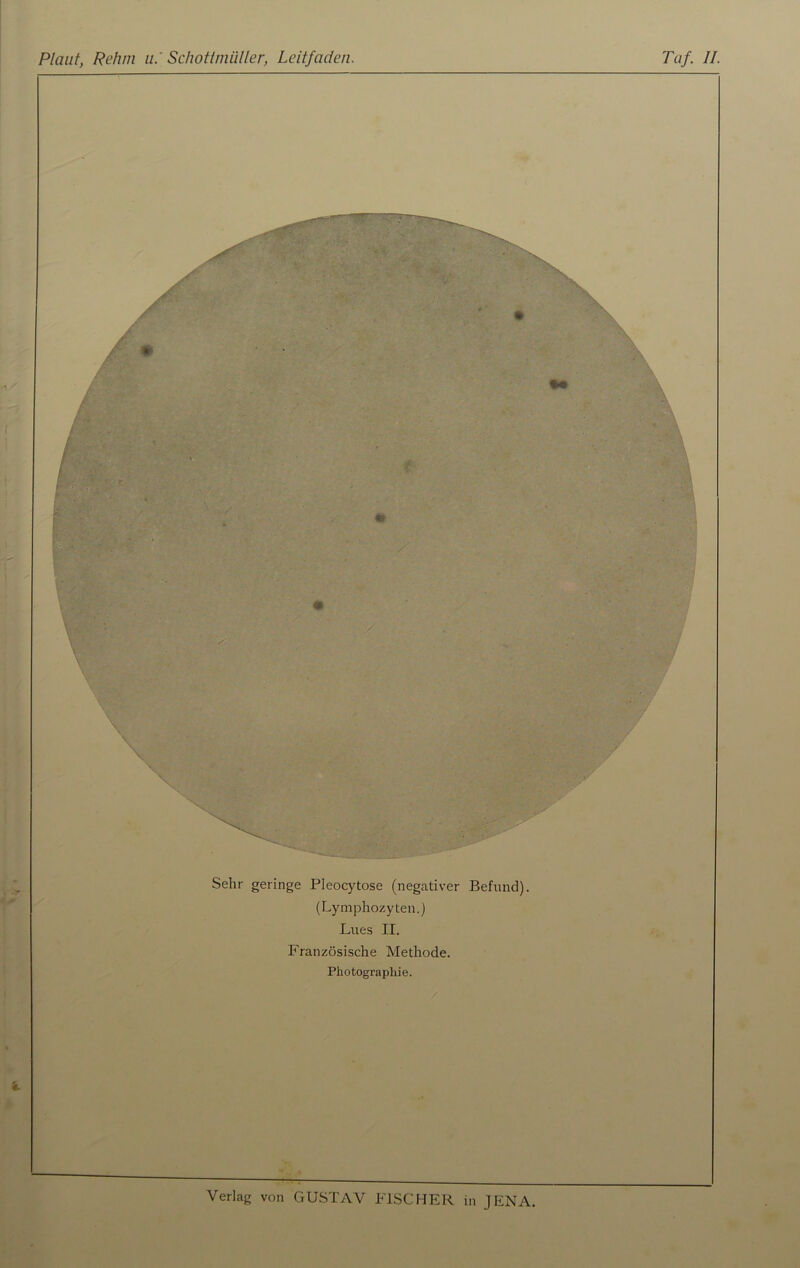 Sehr geringe Pleocytose (negativer Befund). (Lymphozyten.) Lues II. Französische Methode. Photographie.