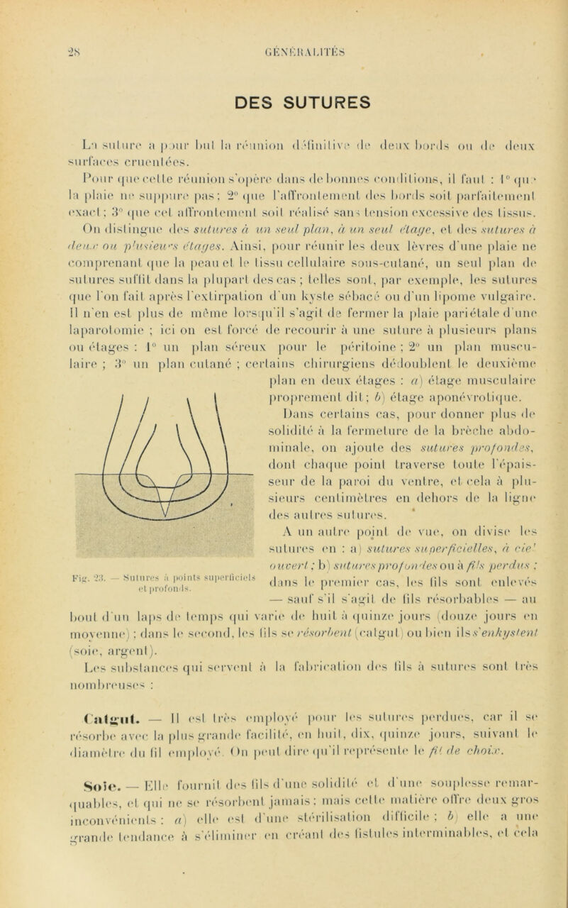 2 N GEN K K ALITES DES SUTURES La suture a pour 1ml la réunion définilive de deux bords ou de deux surfaces cruenlées. Pour que celte réunion s'opère dans de bonnes conditions, il faul : I°que la plaie ne suppure pas; 2° (pie l'affrontement des bords soit parfaitement exact : 3° (pie cet affrontement soit réalisé sans tension excessive des tissus. On distingue des sutures à un seul plan, à un seul étage, et des sutures à deu.r ou plusieurs étages. Ainsi, pour réunir les deux lèvres d'une plaie ne comprenant que la peau et le tissu cellulaire sous-cutané, un seul plan de sutures suftit dans la plupart des cas; telles sont, par exemple, les sutures que l'on fait après l'extirpation d'un kyste sébacé ou d’un lipome vulgaire. 11 n'en est plus de même lorsqu'il s’agit de fermer la plaie pariétale d’une laparotomie ; ici on est forcé de recourir à une suture à plusieurs plans ou étages ; 1° un plan séreux pour le péritoine ; 2° un plan muscu- laire ; 3° un plan cutané ; certains chirurgiens dédoublent le deuxième plan en deux étages : a) étage musculaire proprement dit; b) étage aponévrotique. Dans certains cas, pour donner plus de solidité à la fermeture de la brèche abdo- minale, on ajoute des sutures profondes, dont chaque point traverse toute l'épais- seur de la paroi du ventre, et cela à plu- sieurs centimètres en dehors de la ligne des autres sutures. A un autre pojnt de vue, on divise les sutures en : a) sutures superficielles, à ciel ouvert ; b) sutures prof ondes ou à fils perdus ; dans le premier cas, les fils sont enlevés — sauf s’il s'agit de fils résorbables — au bout d’un laps de temps qui varie de huit à quinze jours (douze jours en movenne) ; dans le second, les (ils se résorbent (catgut) ou bien ils s'enkystent (soie, argent). Les substances qui servent à la fabrication des Ii 1 s à sutures sont très nombreuses ; Fi. 23. — Sutures ù points superficiels et profonds. Calant. — Il est très employé pour les sutures perdues, car il se résorbe avec la plus grande facilité, en huit, dix, quinze jours, suivant le diamètre du fil employé. On peut dire qu’il représente le fU de choix. S0je. Elle fournit des fils d'une solidité et d'une souplesse remar- quables, et qui ne se résorbent jamais ; mais cette matière oflre deux gros inconvénients ; a) elle est d une stérilisation difficile , b> ellr a une grande tendance è s'éliminer en créant des fistules interminables, et cela