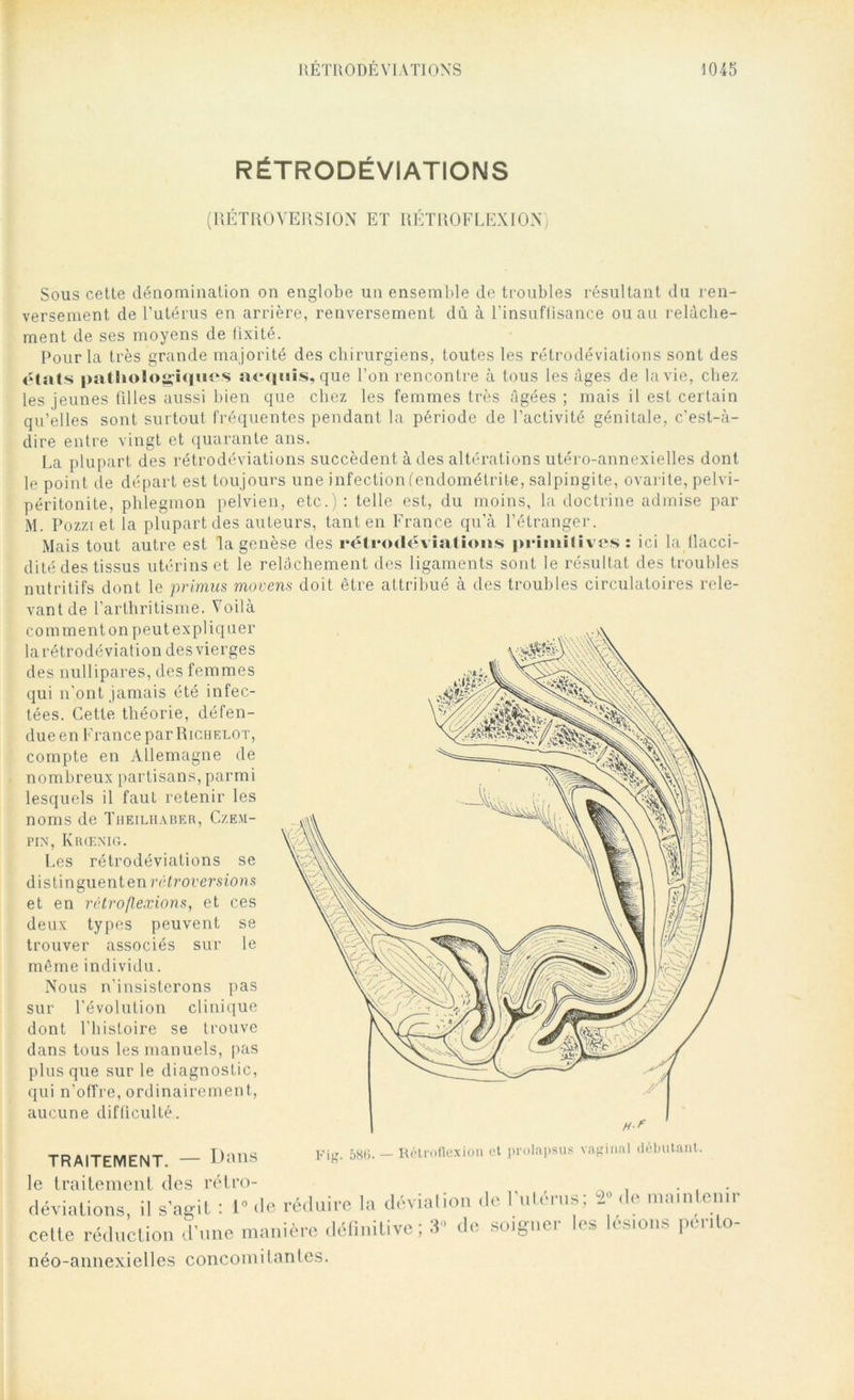 RÉTRODÉVIATIONS (RÉTROVERSION ET RÉTROFLEXION) Sous cette dénomination on englobe un ensemble de troubles résultant du ren- versement de l’utérus en arrière, renversement du à l’insuffisance ou au relâche- ment de ses moyens de fixité. Pour la très grande majorité des chirurgiens, toutes les rétrodéviations sont des étais pathologiques acquis, que l’on rencontre à tous les âges de la vie, chez, les jeunes filles aussi bien que chez les femmes très figées ; mais il est certain qu’elles sont surtout fréquentes pendant la période de l’activité génitale, c'est-à- dire entre vingt et quarante ans. La plupart des rétrodéviations succèdent à des altérations utéro-annexielles dont le point de départ est toujours une infection (endométrite, salpingite, ovarite, pelvi- péritonite, phlegmon pelvien, etc.) : telle est, du moins, la doctrine admise par M. Pozzi et la plupart des auteurs, tant en France qu’à l’étranger. Mais tout autre est la genèse des rétrodéviations primitives: ici la flacci- dité des tissus utérins et le relâchement des ligaments sont le résultat des troubles nutritifs dont le primus movens doit être attribué à des troubles circulatoires rele- vant de l’arthritisme. Voilà comment on peut expliquer la rétrodéviation des vierges des nullipares, des femmes qui n’ont jamais été infec- tées. Cette théorie, défen- due en France par Richelot, compte en Allemagne de nombreux partisans, parmi lesquels il faut retenir les noms de Theilhaber, Czem- pin, Krœnig. Les rétrodéviations se distinguent en rétroversions et en rétro flexions, et ces deux types peuvent se trouver associés sur le même individu. Nous n’insisterons pas sur l’évolution clinique dont l’histoire se trouve dans tous les manuels, pas plus que sur le diagnostic, qui n’offre, ordinairement, aucune difficulté. TRAITEMENT. — Dans Fig. 586. - Rétroflexion et prolapsus vaginal débutant. le traitement des rétro- . déviations, il s'agit : 1» de réduire la déviation de l’utérus; 8» de maintenir celte réduction d'une manière définitive ; 3“ de soigner les lésions pente- néo-annexielles concomitantes.
