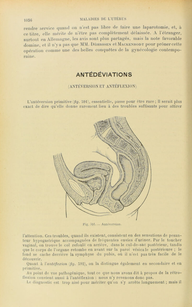 rendre service quand on n’est, pas libre de faire une laparotomie, et, à ce titre, elle mérite de n’être pas complètement délaissée. A l’étranger, surtout en Allemagne, les avis sont plus partagés, mais la note favorable domine, et il n’y a pas que MM. Dührssen et Mackenrodt pour prôner cette opération comme une des belles conquêtes de la gynécologie contempo- raine. ANTÉDÉVIATIONS (ANTÉVERSION ET ANTÉFLEXION) L’antéversion primitive (fig. 591), essentielle, passe pour être rare; 11 serait plus exact de dire qu’elle donne rarement lieu à des troubles suffisants pour attirer Fig. 591. — Antéversion. l’attention. Ces troubles, quand ils existent, consistent en des sensations de pesan- teur hypogastrique accompagnées de fréquentes envies d’uriner. Par le toucher vaginal, on trouve le col refoulé en arrière, dans le cul-de-sac postérieur, tandis que le corps de l’organe retombe en avant sur la paroi vésicale postérieure ; le fond se cache derrière la symphyse du pubis, où il n’est pas très facile de le découvrir. Quant à Vanté flexion (fig. 592), on la distingue également en secondaire et en primitive. Au point de vue pathogénique, tout ce que nous avons dit à propos de la rétro- llexion convient aussi à l’antéflexion : nous n’y revenons donc pas. Le diagnostic est trop aisé pour mériter qu’on s'y arrête longuement ; mais il