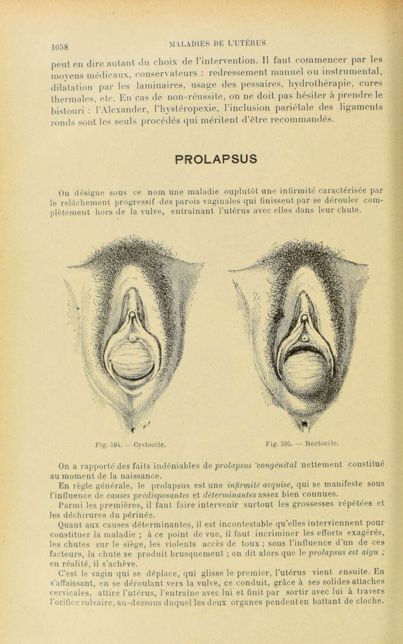 peut en dire autant du choix de l’intervention. 11 faut commencer par les moyens médicaux, conservateurs : redressement manuel ou instrumental, dilatation par les laminaires, usage des pessaires, hydrothérapie, cures thermales, etc. En cas de non-réussite, on ne doit pas hésiter à prendre le bistouri : l’Alexander, l’hystéropexie, l’inclusion pariétale des ligaments ronds sont les seuls procédés qui méritent d’être recommandés. PROLAPSUS On désigne sous ce nom une maladie ouplutôt une infirmité caractérisée par le relâchement progressif des parois vaginales qui finissent par se dérouler com- plètement hors de la vulve, entraînant l’utérus avec elles dans leur chute. Fig. 594. — Cystocèle. Fig. 595. — Rectocèlc. On a rapporté des faits indéniables de prolapsus congénital nettement constitué au moment de la naissance. En règle générale, le prolapsus est une infirmité acquise, qui se manifeste sous l’influence de causes prédisposantes et déterminantes assez bien connues. Parmi les premières, il faut faire intervenir surtout les grossesses répétées et les déchirures du périnée. Quant aux causes déterminantes, il est incontestable qu'elles interviennent pour constituer la maladie ; à ce point de vue, il faut incriminer les eflorts exagérés, les chutes sur le siège, les violents accès de toux ; sous l’influence d un de ces facteurs, la chute se produit brusquement ; on dit alors que le prolapsus est aigu ; en réalité, il s’achève. C’est le vagin qui se déplace, qui glisse le premier, l'utérus vient ensuite. En s’affaissant, en se déroulant vers la vulve, ce conduit, grâce à ses solides attaches cervicales, attire l’utérus, l'entraîne avec lui et finit par sortir avec lui à travers l’orifice vulvaire, au-dessous duquel les deux organes pendenten battant de cloche.