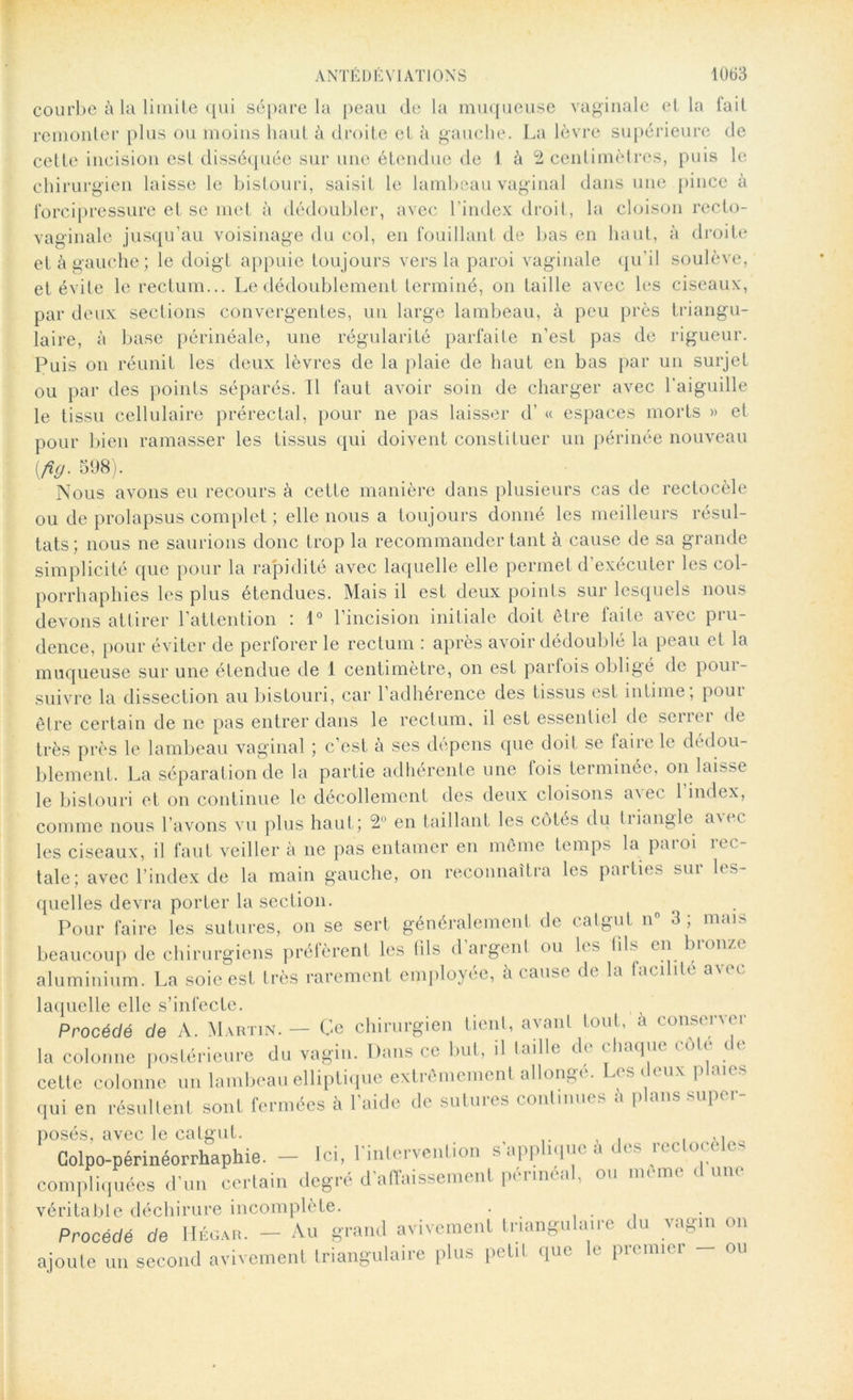 courbe à la limite qui sépare la peau de la muqueuse vaginale et la fait remonter plus ou moins haut à droite et à gauche. La lèvre supérieure de cette incision est disséquée sur une étendue de 1 à 2 centimètres, puis le chirurgien laisse le bistouri, saisit le lambeau vaginal dans une pince à forci pressure et se met à dédoubler, avec l'index droit, la cloison recto- vaginale jusqu’au voisinage du col, en fouillant de bas en haut, à droite et à gauche; le doigt appuie toujours vers la paroi vaginale qu’il soulève, et évite le rectum... Le dédoublement terminé, on taille avec les ciseaux, par deux sections convergentes, un large lambeau, à peu près triangu- laire, à base périnéale, une régularité parfaite n’est pas de rigueur. Puis on réunit les deux lèvres de la plaie de haut en bas par un surjet ou par des points séparés. Il faut avoir soin de charger avec l’aiguille le tissu cellulaire prérectal, pour ne pas laisser d’ « espaces morts » et pour bien ramasser les tissus qui doivent constituer un périnée nouveau [fig- 598). Nous avons eu recours à cette manière dans plusieurs cas de rectocèle ou de prolapsus complet ; elle nous a toujours donné les meilleurs résul- tats; nous ne saurions donc trop la recommander tant à cause de sa grande simplicité que pour la rapidité avec laquelle elle permet d’exécuter les eol- porrhaphies les plus étendues. Mais il est deux points sur lesquels nous devons attirer l’attention : 1° l’incision initiale doit être faite avec pru- dence, pour éviter de perforer le rectum : après avoir dédoublé la peau et la muqueuse sur une étendue de 1 centimètre, on est parfois obligé de pour- suivre la dissection au bistouri, car l’adhérence des tissus est intime; poui être certain de ne pas entrer dans le rectum, il est essentiel de serrer de très près le lambeau vaginal ; c’est à ses dépens que doit se faire le dédou- blement. La séparation de la partie adhérente une lois terminée, on laisse le bistouri et on continue le décollement des deux cloisons avec l’index, comme nous l’avons vu plus haut; 2 en taillant les côtés du tiiangle n\ec les ciseaux, il faut veiller à ne pas entamer en même temps la paroi rec- tale; avec l’index de la main gauche, on reconnaîtra les parties sur les- quelles devra porter la section. Pour faire les sutures, on se sert généralement de catgut n° 3 ; mais beaucoup de chirurgiens préfèrent les (Ils d’argent ou les fils en bronze aluminium. La soie est très rarement employée, à cause de la facilite avec laquelle elle s’infecte. Procédé de A. Martin. — Ce chirurgien tient, avant tout, a consenor la colonne postérieure du vagin. Dans ce but, il taille de chaque cote t e cette colonne un lambeau elliptique extrêmement allonge. ( s < < ux p qui en résultent sont fermées à l’aide de sutures continues à plans super- posés, avec le catgut. , ,, Colpo-périnéorrhaphie. — Ici, l'intervention s'applique à des rccloce es compliquées d'un certain degré d'affaissement périnéal, ou meme d une véritable déchirure incomplète. Procédé de Hégar. — Au grand avivement triangulaire d u vagin on ri uocuc uv o . , • ajoute un second avivement triangulaire plus petit que le premier -