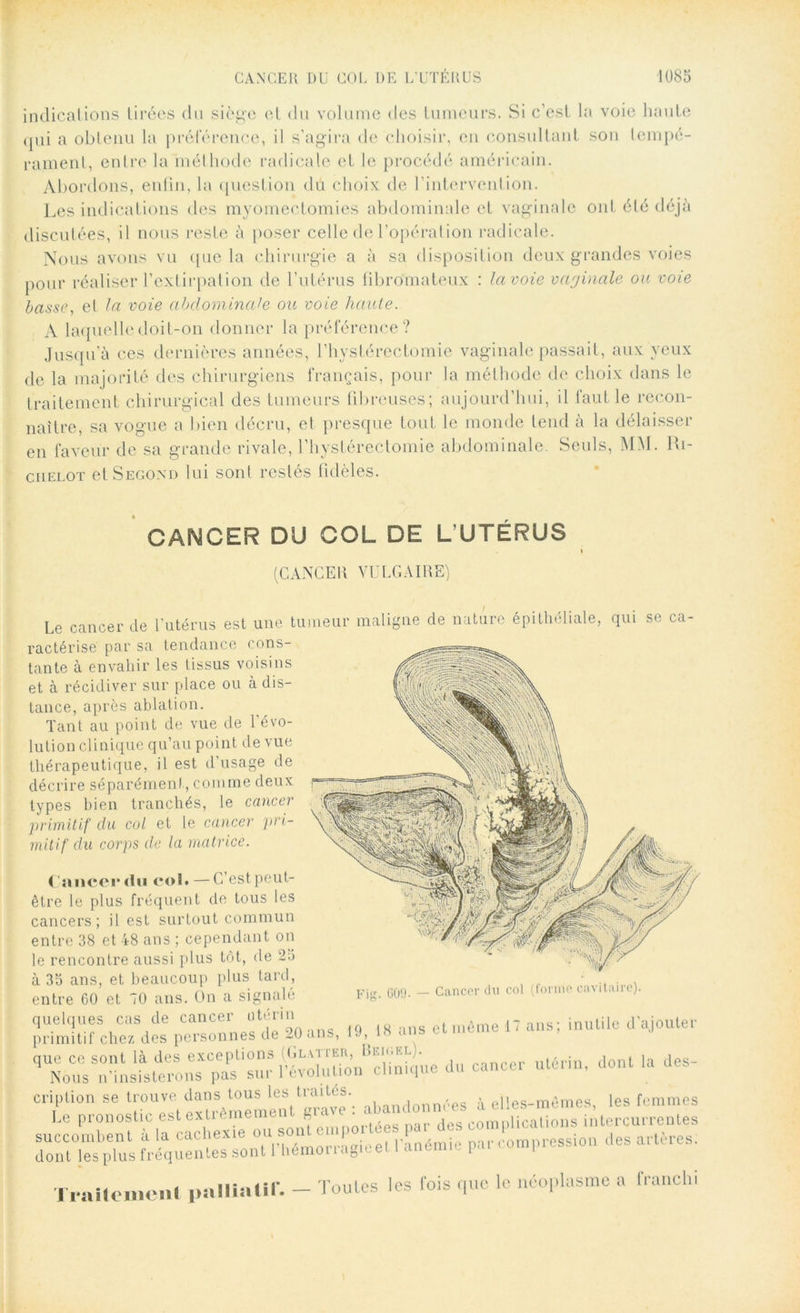 indications tirées du sièg'e et du volume des tumeurs. Si c’est la voie haute qui a obtenu la préférence, il s’agira de choisir, en consultant son tempé- rament, entre la méthode radicale et le procédé américain. Abordons, enfin, la question dû choix de l’intervention. Les indications des myomectomies abdominale et vaginale ont été déjà discutées, il nous reste à poser celle de l’opération radicale. Nous avons vu que la chirurgie a à sa disposition deux grandes voies pour réaliser l’extirpation de l’utérus fibromateux : lavoie vaginale ou voie basse, el la voie abdominale ou voie haute. A laquelle doit-on donner la préférence? Jusqu’à ces dernières années, l’hystérectomie vaginale passait, aux yeux de la majorité des chirurgiens français, pour la méthode de choix dans le traitement chirurgical des tumeurs fibreuses; aujourd’hui, il faut le recon- naître, sa vogue a bien décru, et presque tout le monde tend à la délaisser en faveur de sa grande rivale, l’hystérectomie abdominale. Seuls, MM. Ri- chelot et Second lui sont restés fidèles. CANCER DU COL DE L’UTÉRUS (CANCER VULGAIRE) Le cancer de l’utérus est une tumeur maligne de nature épithéliale, qui se ca ractérise par sa tendance cons- tante à envahir les tissus voisins et à récidiver sur place ou à dis- tance, après ablation. Tant au point de vue de l’évo- lution clinique qu’au point de vue thérapeutique, il est d’usage de décrire séparément, connue deux types bien tranchés, le cancer primitif du col et le cancer pri- mitif du corps de la matrice. Cancer du en!» —C’est peut- être le plus fréquent cle tous les cancers; il est surtout commun entre 38 et 48 ans ; cependant on le rencontre aussi plus tôt, de 25 à 35 ans, et beaucoup plus tard, entre 60 et 70 ans. Un a signalé Fig. 009. — Cancer du col (forme cavitaire). uelques cas de cancer utérin ,8 ans et même 17 ans; inutile d'ajouter rimitif chez des personnes de 20 ans, 1 -h l« ans ue ce sont là des exceptions (Glatieu, Rkk.el). nlrrin dont la des- Nous n'insisterons pas sur l'évolution clinique du cancci utum, dont la Traitement palliatif» loub s les fois que le néoplasme a franchi