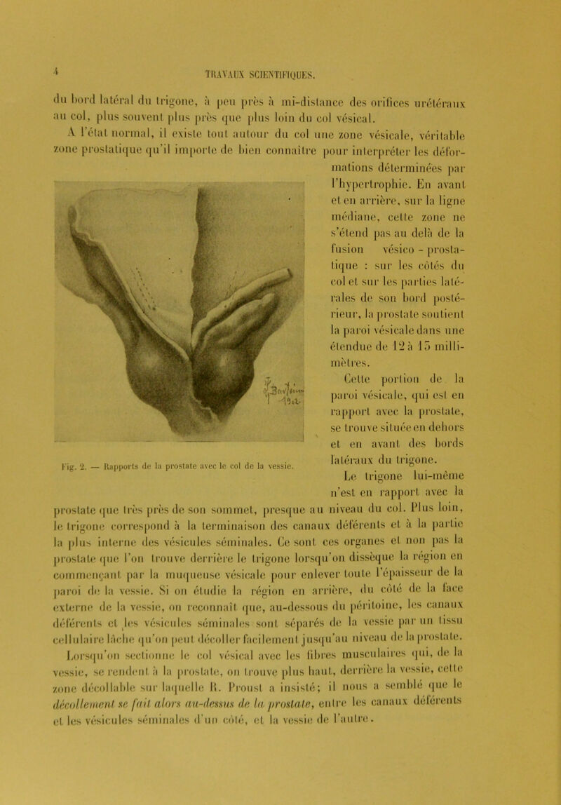 i du bord latéral du trigone, à peu près à mi-distance des orifices urétéraux au col, plus souvent plus près que plus loin du col vésical. A l’état normal, il existe tout autour du col une zone vésicale, véritable zone prostatique qu’il importe de bien connaître pour interpréter les défor- mations déterminées par l’hypertrophie. En avant et en arrière, sur la ligne médiane, celte zone ne s’étend pas au delà de la fusion vésieo - prosta- tique : sur les côtés du col et sur les parties laté- rales de son bord posté- rieur, la prostate soutient la paroi vésicale dans une étendue de 12 à 15 milli- mètres. Cette portion de la paroi vésicale, qui est en rapport avec la prostate, se trouve située en dehors v et en avant des bords ... „ n ... , , , „ . . , . latéraux du trigone. Le trigone lui-même n’est en rapport avec la prostate que très près de son sommet, presque au niveau du col. Plus loin, le trigone correspond à la terminaison des canaux déférents et a la partie la plus interne des vésicules séminales. Ce sont ces organes et non pas la prostate que l’on trouve derrière le trigone lorsqu’on dissèque la région en commençant par la muqueuse vésicale pour enlever toute l’épaisseur de la paroi de la vessie. Si on étudie la région en arrière, du côté de la lace externe de la vessie, ou reconnaît que, au-dessous du péritoine, les canaux déférents cl les vésicules séminales sont séparés de la vessie par un tissu cellulaire lâche qu’on peut décoller facilement jusqu'au niveau de la prostate. Lorsqu’on sectionne le col vésical avec les fibres musculaires qui, de la vessie, se rendent à la prostate, on trouve plus haut, derrière la vessie, celle zone décollabié sur laquelle IL Proust a insisté; il nous a semblé que le décollement se fait alors au-dessus de la prostate, entre les canaux délérents et les vésicules séminales d’un côté, et la vessie de l’autre.