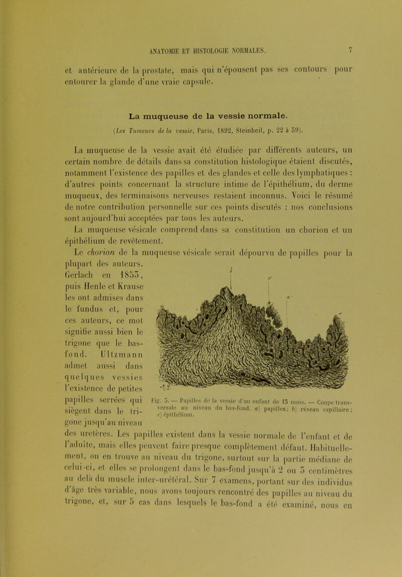 el antérieure de la prostate, mais qui n’épousent pas ses contours pour entourer la glande d’une vraie capsule. La muqueuse de la vessie normale. (Les Tumeurs delà vessie, Paris, 1892, Sleinheil, p. 22 à 59). La muqueuse de la vessie avait été étudiée par différents auteurs, un certain nombre de détails dans sa constitution histologique étaient discutés, notamment l’existence des papilles et des glandes et celle des lymphatiques : d’autres points concernant la structure intime de l’épithélium, du derme muqueux, des terminaisons nerveuses restaient inconnus. Yoici le résumé de notre contribution personnelle sur ces points discutés : nos conclusions sont aujourd’hui acceptées par tous les auteurs. La muqueuse vésicale comprend dans sa constitution un chorion et un épithélium de revêtement. Le chorion de la muqueuse vésicale serait dépourvu de papilles pour la plupart des auteurs. Gerlach en 1855, puis llenle et Krause les ont admises dans le fundus et, pour ces auteurs, ce mot signifie aussi bien le trigone que le bas- fond. Ultzmann admet aussi dans quelques vessies l’existence de petites papilles serrées qui siègent dans le Iri- gone jusqu’au niveau des uretères. Les papilles existent dans la vessie normale de l’enfant et de l’adulte, mais elles peuvent faire presque complètement défaut. Habituelle- ment, on en trouve au niveau du trigone, surtout sur la partie médiane de celui-ci, et elles se prolongent dans le bas-fond jusqu’à 2 ou 5 centimètres au delà du muscle inter-urétéral. Sur 7 examens, portant sur des individus d’âge très variable, nous avons toujours rencontré des papilles au niveau du trigone, et, sur 5 cas dans lesquels le bas-fond a été examiné, nous en Eig. 3. — Papilles de la vessie d'un enfant de 13 mois. — Coupe trans- versale au niveau du bas-fond, a) papilles; b) réseau capillaire; c) épithélium.