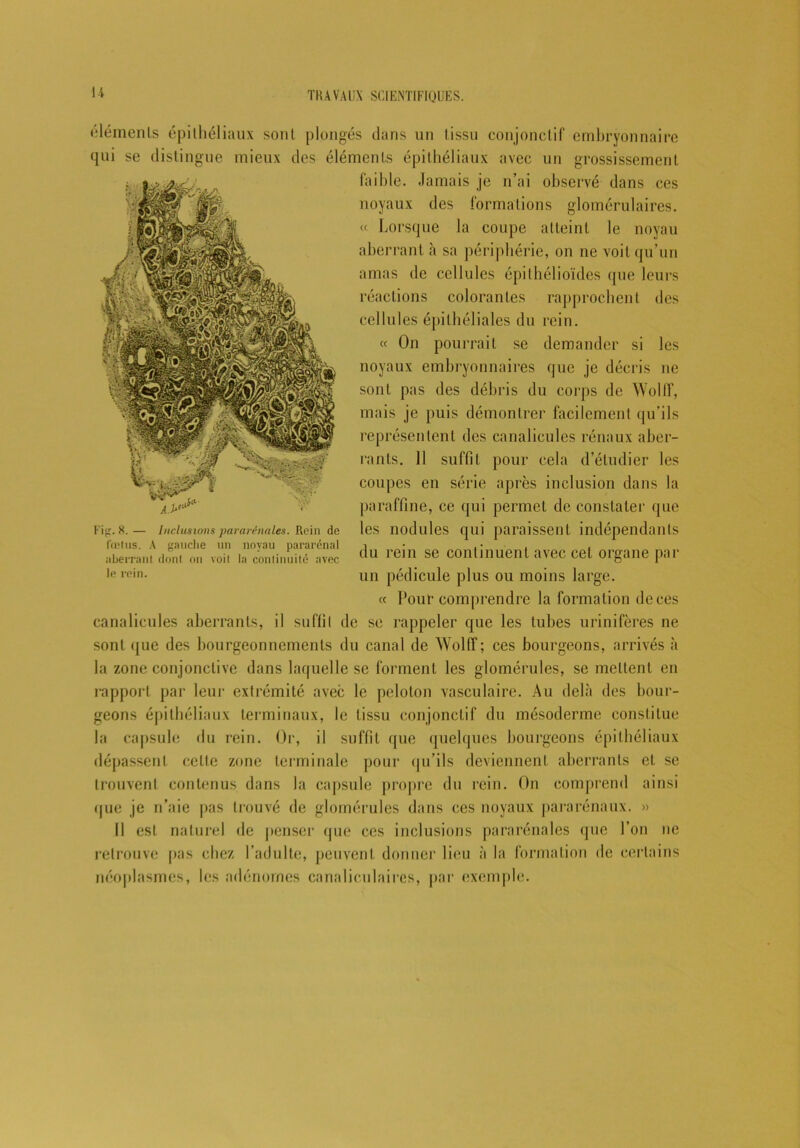 U éléments épithéliaux sont plongés dans un tissu conjonctif embryonnaire qui se distingue mieux des éléments épithéliaux avec un grossissement faible. Jamais je n’ai observé dans ces noyaux des formations glomérulaires. « Lorsque la coupe atteint le noyau aberrant à sa périphérie, on ne voit qu’un amas de cellules épithélioïdes que leurs réactions colorantes rapprochent des cellules épithéliales du rein. « On pourrait se demander si les noyaux embryonnaires que je décris ne sont pas des débris du corps de Wolff, mais je puis démontrer facilement qu’ils représentent des canalicules rénaux aber- rants. 11 suffit pour cela d’étudier les coupes en série après inclusion dans la paraffine, ce qui permet de constater que les nodules qui paraissent indépendants du rein se continuent avec cet organe par un pédicule plus ou moins large. « Pour comprendre la formation de ces canalicules aberrants, il suffit de se rappeler que les tubes urinifères ne sont ([ue des bourgeonnements du canal de Wolff; ces bourgeons, arrivés à la zone conjonctive dans laquelle se forment les glomérules, se mettent en rapport par leur extrémité avec le peloton vasculaire. Au delà des bour- geons épithéliaux terminaux, le tissu conjonctif du mésoderme constitue la capsule du rein. Or, il suffit que quelques bourgeons épithéliaux dépassent celle zone terminale pour qu’ils deviennent aberrants et se trouvent contenus dans la capsule propre du rein. On comprend ainsi (jue je n’aie pas trouvé de glomérules dans ces noyaux pararénaux. » Il est naturel de penser que ces inclusions pararénales que l’on ne retrouve pas chez l’adulte, peuvent donner lieu à la formation de certains néoplasmes, les adénomes canaliculaires, par exemple. AM* Fi. S. — Inclusions pararénales. Rein de fœtus. A gauche un noyau pararénal aberrant dont on voit la continuité avec le rein.