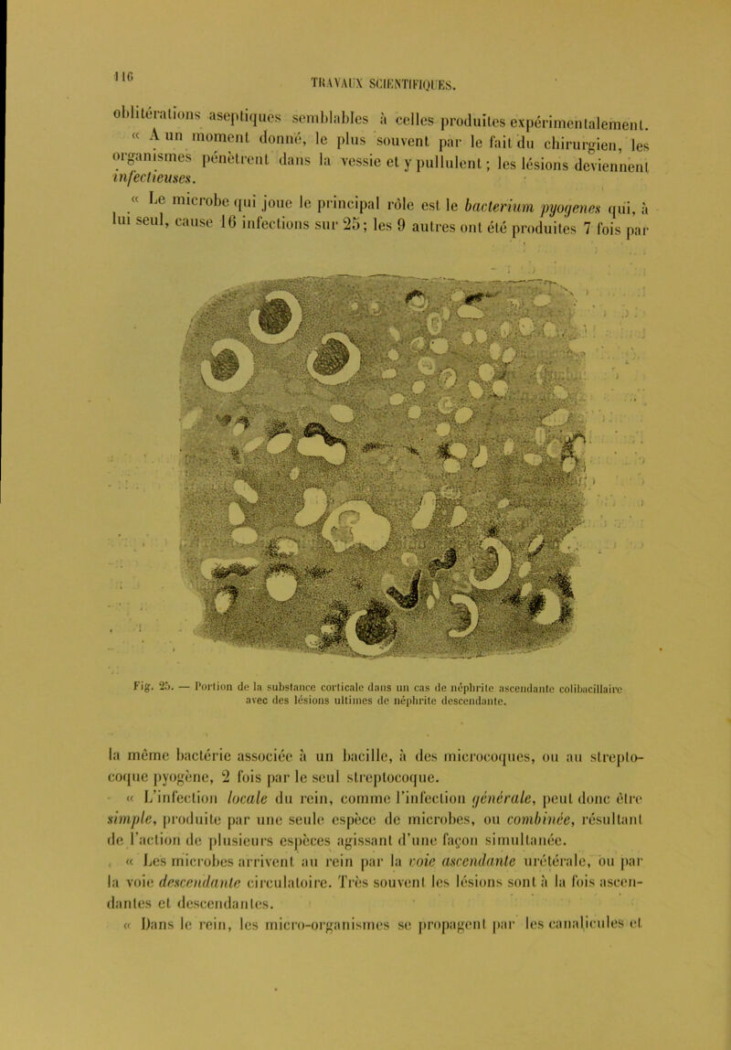 TRAVAUX SCIENTIFIQUES. oblitérations aseptiques semblables à celles produites expérimentalement. « A un moment donné, le plus souvent par le fait du chirurgien, les organismes pénètrent dans la vessie et y pullulent ; les lésions deviennent infectieuses. « Le microbe qui joue le principal rôle est le bacterium pyogenes qui, à lui seul, cause 16 infections sur 25; les 9 autres ont été produites 7 fois par Fig. 25. — Portion de la substance corticale dans un cas de néphrite ascendante colibacillaire avec des lésions ultimes de néphrite descendante. la même bactérie associée à un bacille, à des microcoques, ou au strepto- coque pyogène, 2 fois par le seul streptocoque. « L’infection locale du rein, comme l’infection générale, peut donc être simple, produite par une seule espèce de microbes, ou combinée, résultant de faction de plusieurs espèces agissant d’une façon simultanée. « Les microbes arrivent au rein par la voie ascendante urétérale, ou par la voie descendante circulatoire. Très souvent les lésions sont à la fois ascen- dantes et descendantes. (( Dans le rein, les micro-organismes se propagent par les canalieules et