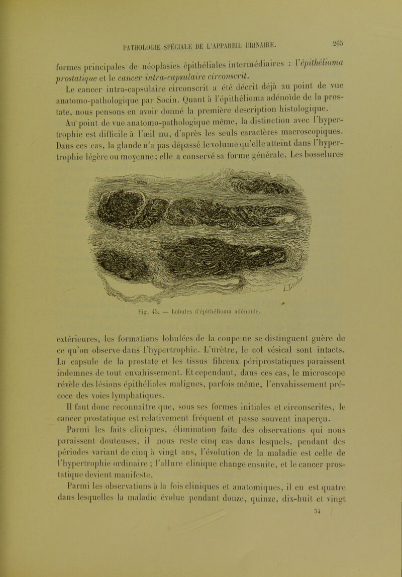 PATHOLOGIE SPÉCIALE DE L’AI'PAHEIL URliNAIIlE. ‘ilia formes principales de néoplasies épithéliales intermédiaires : I épilhelwma prostatique et le cancer uitra-capsulaire circonscrit. Le cancer intra-capsulaire circonscrit a été décrit déjà au point de uie anatomo-pathologique par Socin. Quant à 1 epithélioma adénoïde de la pros- tate, nous pensons en avoir donné la première description histologique. Aupoint de vue anatomo-pathologique même, la distinction avec I hypo- trophie est difficile à l’œil nu, d’après les seuls caractères macroscopiques. Dans ces cas, la glande n’a pas dépassé le volume qu’elle atteint dans 1 hyper- trophie légère ou moyenne; elle a conservé sa forme générale. Les bosselures extérieures, les formations lohulées de la coupe ne se distinguent guère de ce qu’on observe dans l’hypertrophie. L’urètre, le col vésical sont intacts. La capsule de la prostate et les tissus fibreux périprostatiques paraissent indemnes de tout envahissement. Et cependant, dans ces cas, le microscope révèle des lésions épithéliales malignes, parfois même, l’envahissement pré- coce des voies lymphatiques. Il faut donc reconnaître que, sous ses formes initiales et circonscrites, le cancer prostatique est relativement fréquent cl passe souvent inaperçu. Parmi les laits cliniques, élimination faite des observations qui nous paraissent douteuses, il nous reste cinq cas dans lesquels, pendant des périodes variant de cinq à vingt ans, l’évolution de la maladie est celle de I hypertrophie ordinaire ; 1 allure clinique change ensuite, et locaneer pros- tatique devient manifeste. Parmi les observations à la fois cliniques et anatomiques, il en est quatre dans lesquelles la maladie évolue pendant douze, quinze, dix-huit et vingt