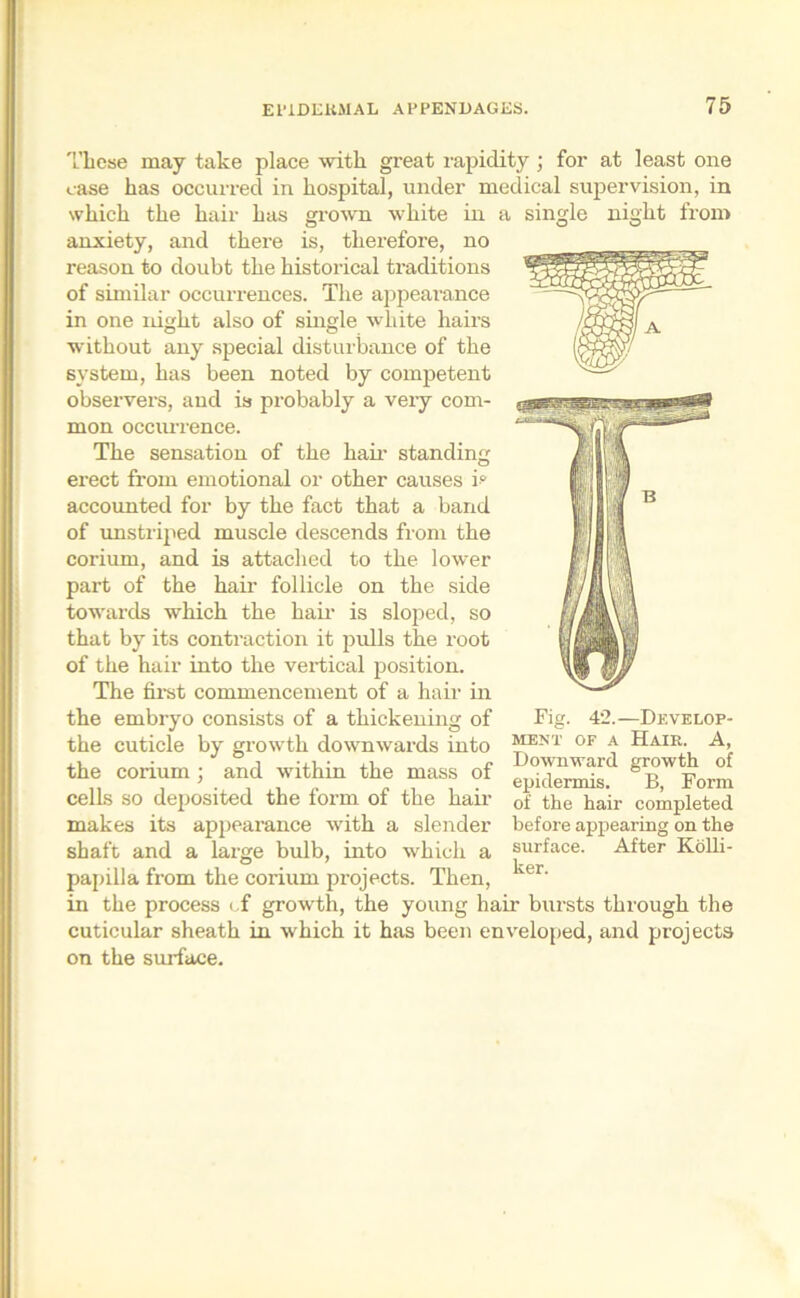 These may take place with great rapidity ; for at least one case has occurred in hospital, under medical supervision, in which the hair has grown white in a single night from anxiety, and there is, therefore, no reason to doubt the historical traditions of similar occurrences. The appearance in one night also of single white hairs without any special disturbance of the system, has been noted by competent observers, and is probably a very com- mon occurrence. The sensation of the hair standing erect from emotional or other causes i° accounted for by the fact that a band of unstriped muscle descends from the corium, and is attached to the lower part of the hair follicle on the side towards which the hair is sloped, so that by its contraction it pulls the root of the hair into the vertical position. The first commencement of a hair in the embryo consists of a thickening of the cuticle by growth downwards into the corium ; and within the mass of cells so deposited the form of the hair makes its appearance with a slender shaft and a large bulb, into which a papilla from the corium projects. Then, in the process cf growth, the young hair bursts through the cuticular sheath in which it has been enveloped, and projects on the surface. Fig. 42.—Develop- ment of a Hair. A, Downward growth of epidermis. B, Form of the hair completed before appearing on the surface. After Kolli- ker.