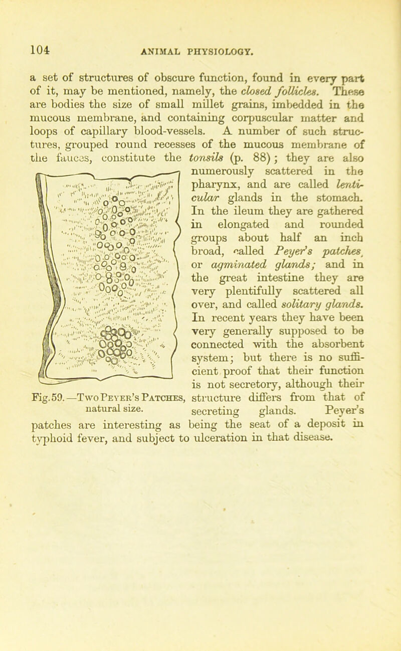 'JoW a set of structures of obscure function, found in every part of it, may be mentioned, namely, the closed follicles. These are bodies the size of small millet grains, imbedded in the mucous membrane, and containing corpuscular matter and loops of capillary blood-vessels. A number of such struc- tures, grouped round recesses of the mucous membrane of the fauces, constitute the tonsils (p. 88); they are also numerously scattered in the pharynx, and are called lentil cular glands in the stomach. \ ''ifIn the ileum they are gathered in elongated and rounded groups about half an inch broad, called Peyer's patches, or agminated glands; and in the great intestine they are very plentifully scattered all over, and called solitary glands. In recent years they have been very generally supposed to be connected ■with the absorbent system; but there is no suffi- cient proof that their function is not secretory, although their Fig. 59.—Two Peyer’s Patches, structure differs from that of natural size. secreting glands. Peyer’s patches are interesting as being the seat of a deposit in typhoid fever, and subject to ulceration in that disease. ' i„Q»P O O0i;:;;!!,i V..V;-'.ri 1.9 : V-■! >.. O.yp 1 63... ;.-v00OiP-/;7llfl . inn' '.'i'1 '• W !|l<*