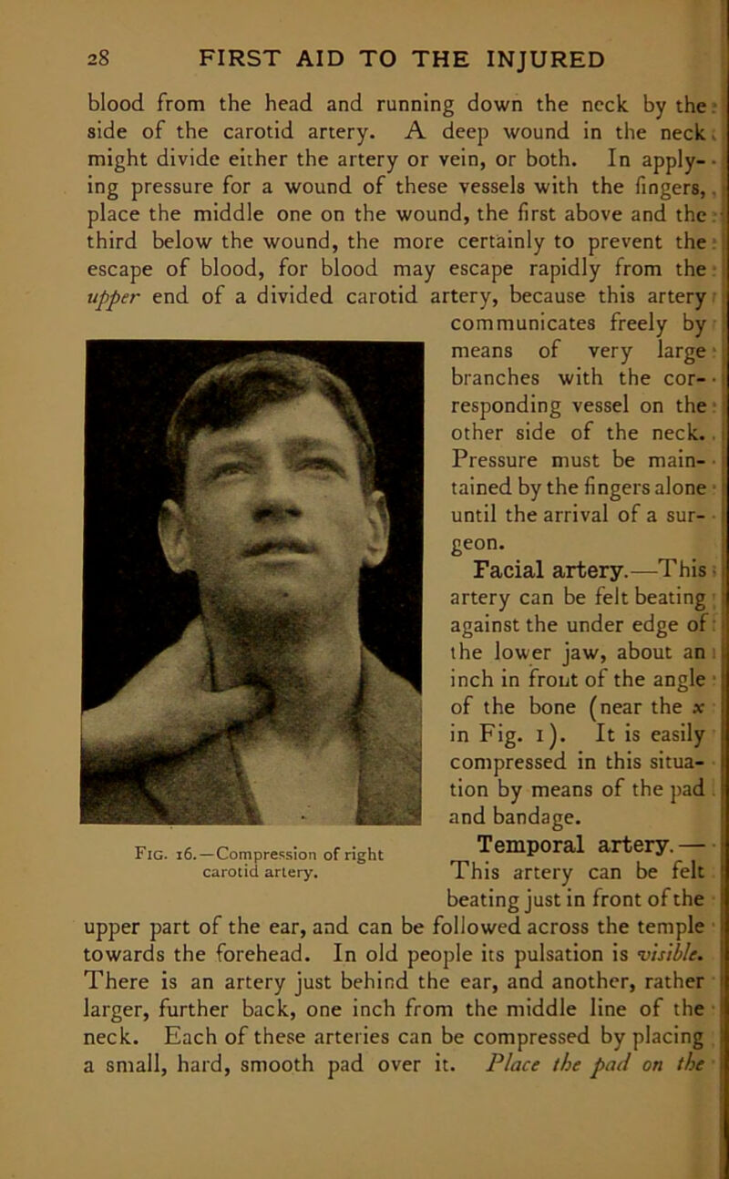 blood from the head and running down the neck by the side of the carotid artery. A deep wound in the neck; might divide either the artery or vein, or both. In apply- ing pressure for a wound of these vessels with the fingers,. place the middle one on the wound, the first above and the ■ third below the wound, the more certainly to prevent the escape of blood, for blood may escape rapidly from the upper end of a divided carotid artery, because this artery communicates freely by means of very large1 [ branches with the cor- ■ responding vessel on the other side of the neck.. i Pressure must be main- ■ | tained by the fingers alone I until the arrival of a sur- geon. Facial artery.—This artery can be felt beating i against the under edge of:; the lower jaw, about an inch in front of the angle j of the bone (near the x in Fig. i). It is easily I compressed in this situa- ! tion by means of the pad ; and bandage. Temporal artery. — [ This artery can be felt I beating just in front of the upper part of the ear, and can be followed across the temple ! towards the forehead. In old people its pulsation is visible. ; There is an artery just behind the ear, and another, rather J larger, further back, one inch from the middle line of the 1 neck. Each of these arteries can be compressed by placing a small, hard, smooth pad over it. Place the pad on the I Fig. i6.—Compression of right carotid artery.