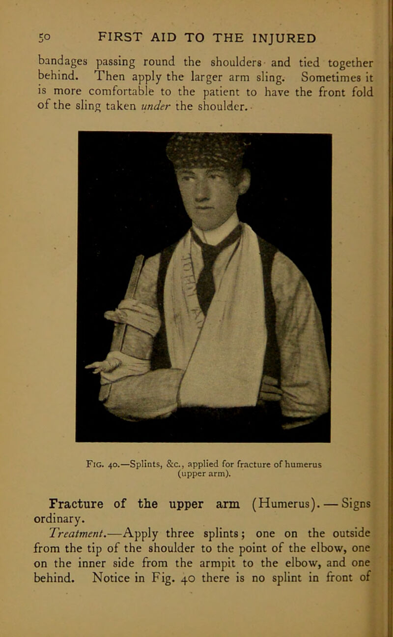 bandages passing round the shoulders and tied together behind. Then apply the larger arm sling. Sometimes it is more comfortable to the patient to have the front fold of the sling taken under the shoulder. - Fig. 40.—Splints, &c., applied for fracture of humerus (upper arm). Fracture of the upper arm (Humerus). — Signs ordinary. Treatment.—Apply three splints; one on the outside from the tip of the shoulder to the point of the elbow, one on the inner side from the armpit to the elbow, and one behind. Notice in Fig. 40 there is no splint in front of