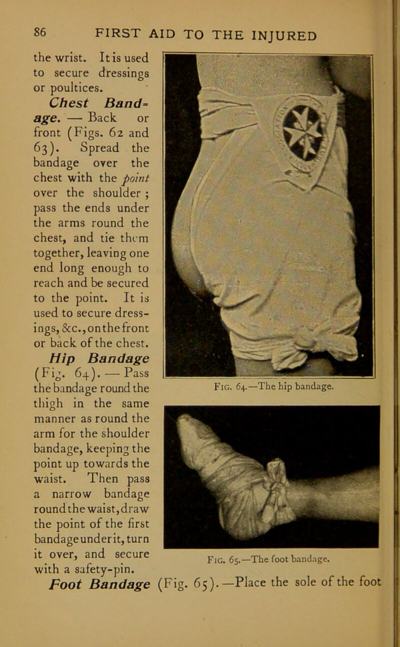 the wrist. It is used to secure dressings or poultices. Chest Band- age. — Back. or front (Figs. 62 and 63). Spread the bandage over the chest with the point over the shoulder ; pass the ends under the arms round the chest, and tie them together, leaving one end long enough to reach and be secured to the point. It is used to secure dress- ings, &c.,onthefront or back of the chest. Hip Bandage (Fig. 64). — Pass the bandage round the thigh in the same manner as round the arm for the shoulder bandage, keeping the point up towards the waist. Then pass a narrow bandage roundthe waist,draw the point of the first bandageunderit, turn it over, and secure with a safety-pin. Foot Bandage (Fig. 65).—Place the sole of the foot Fig. 64.—The hip bandage. Fig. 65.—The foot bandage.