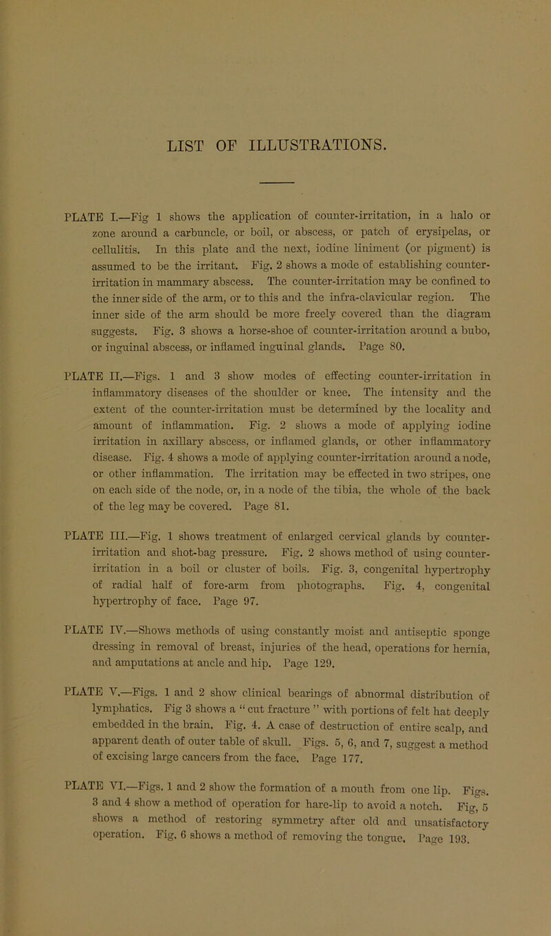 LIST OF ILLUSTRATIONS. PLATE I.—Fig 1 shows the application of counter-irritation, in a halo or zone around a carbuncle, or boil, or abscess, or patch of erysipelas, or cellulitis. In this plate and the next, iodine liniment (or pigment) is assumed to be the in-itant. Fig. 2 shows a mode of establishing counter- irritation in mammary abscess. The counter-irritation may be confined to the inner side of the arm, or to this and the infra-clavicular region. The inner side of the arm should be more freely covered than the diagram suggests. Fig. 3 shows a horse-shoe of counter-irritation around a bubo, or inguinal abscess, or inflamed inguinal glands. Page 80. PLATE II.—Figs. 1 and 3 show modes of effecting counter-irritation in inflammatory diseases of the shoulder or knee. The intensity and the extent of the counter-irritation must be determined by the loeaUty and amount of inflammation. Fig. 2 shows a mode of applying iodine irritation in axillary abscess, or inflamed glands, or other inflammatory disease. Fig. 4 shows a mode of applying counter-irritation around a node, or other inflammation. The irritation may be effected in two stripes, one on each side of the node, or, in a node of the tibia, the whole of the back of the leg maybe covered. Page 81. PLATE III.—Fig. 1 shows treatment of enlarged cervical glands by counter- irritation and shot-bag pressure. Fig. 2 shows method of using counter- irritation in a boil or cluster of boils. Fig. 3, congenital hy|)ertrophy of radial half of fore-arm from photographs. Fig. 4, congenital hypertrophy of face. Page 97. PLATE W.—Shows methods of using constantly moist and antiseptic sponge dressing in removal of breast, injuries of the head, operations for hernia, and amputations at ancle and hip. Page 129. PLATE V.—Figs. 1 and 2 show clinical bearings of abnormal distribution of lymphatics. Fig 3 shows a “ cut fracture ” with portions of felt hat deeply embedded in the brain. Fig. 4. A ease of destruction of entire scalp, and apparent death of outer table of skull. Figs. 6, 6, and 7, suggest a method of excising large cancers from the face. Page 177. PLATE VI.—Figs. 1 and 2 show the formation of a mouth from one lip. Fitrs. 3 and 4 show a method of operation for hare-lip to avoid a notch. Fio-, 5 shows a method of restoring symmetry after old and unsatisfactory operation. Fig. G shows a method of removing the tongue. Page 193.