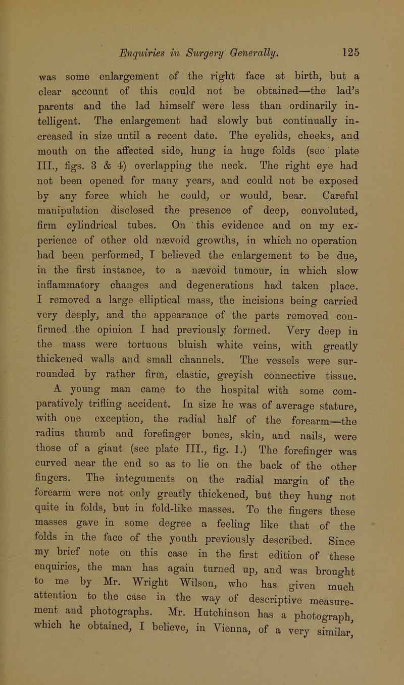 was some enlargement of the right face at birth^ but a clear account of this could not be obtained—the lad^s parents and the lad himself were less than ordinarily in- telligent. The enlargement had slowly but continually in- creased in size until a recent date. The eyehds, cheeks, and mouth on the affected side, hung in huge folds (see' plate III., figs. 3 & 4) overlapping the neck. The right eye had not been opened for many years, and could not be exposed by any force which he could, or would, bear. Careful manipulation disclosed the presence of deep, convoluted, firm cylindrical tubes. On ' this evidence and on my ex- perience of other old ngevoid growths, in which no operation had been performed, I believed the enlargement to be due, in the first instance, to a naevoid tumour, in which slow inflammatory changes and degenerations had taken place. I removed a large elliptical mass, the incisions being carried very deeply, and the appearance of the parts removed con- firmed the opinion I had previously formed. Very deep in the mass were tortuous bluish white veins, with greatly thickened walls and small channels. The vessels were sur- rounded by rather firm, elastic, greyish connective tissue. A young man came to the hospital with some com- paratively trifling accident. In size he was of average stature, with one exception, the radial half of the forearm—the radius thumb and forefinger bones, skin, and nails, were those of a giant (see plate III., fig. 1.) The forefinger was curved near the end so as to lie on the back of the other fingers. The integuments on the radial margin of the forearm were not only greatly thickened, but they hung not quite in folds, but in fold-like masses. To the fingers these masses gave in some degree a feeling like that of the folds in the face of the youth previously described. Since my brief note on this case in the first edition of these enquiries, the man has again turned up, and was brought to me by Mr. Wright Wilson, who has given much attention to the case in the way of descriptive measure- ment and photographs. Mr. Hutchinson has a photograph which he obtained, I believe, in Vienna, of a very similar^