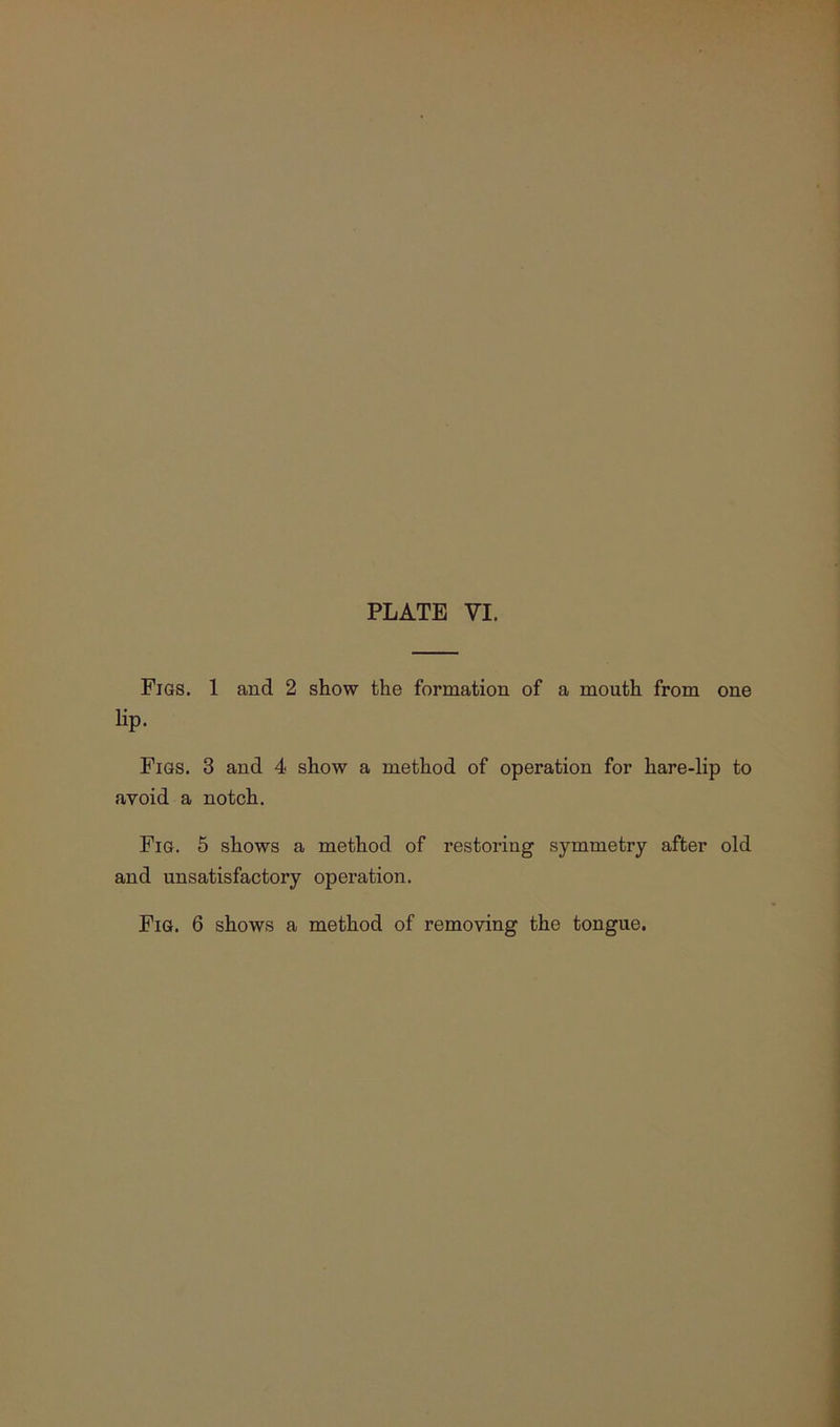 Figs. 1 and 2 show the formation of a mouth from one lip. Figs. 3 and 4 show a method of operation for hare-lip to avoid a notch. Fig. 5 shows a method of restoring symmetry after old and unsatisfactory operation. Fig. 6 shows a method of removing the tongue.