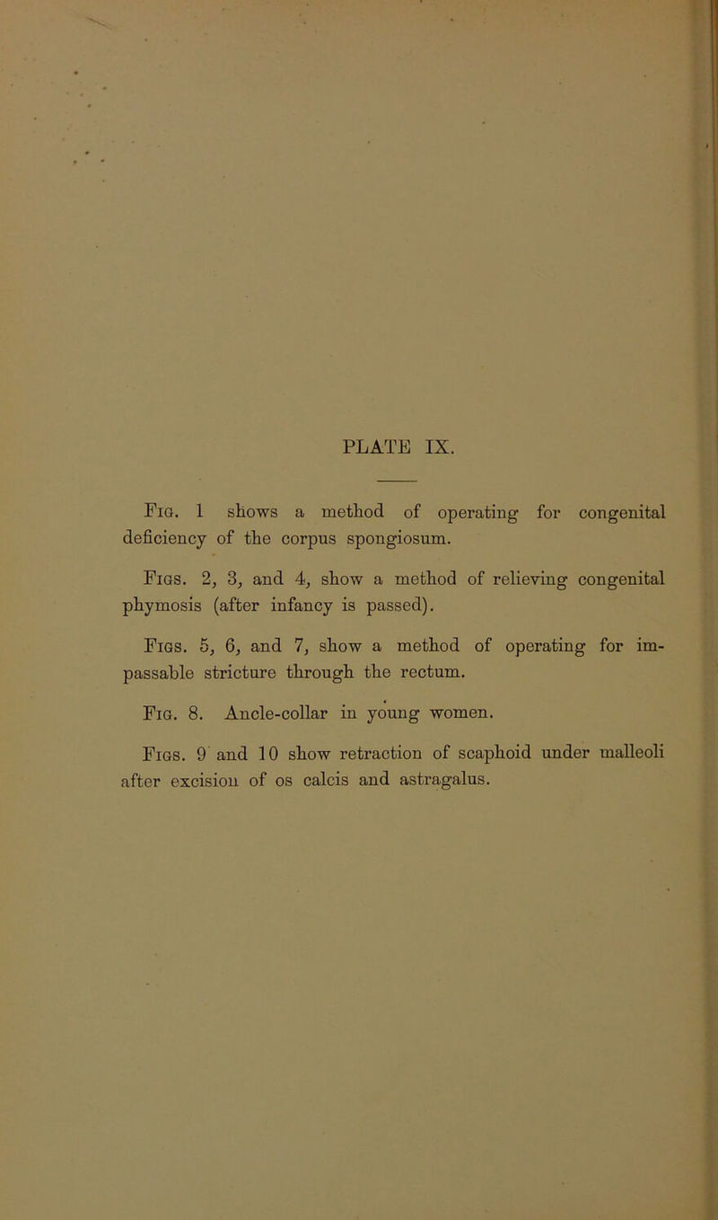 Fig. 1 shows a method of operating for congenital deficiency of the corpus spongiosum. Figs. 2, 3, and 4, show a method of relieving congenital phymosis (after infancy is passed). Figs. 5, Q, and 7, show a method of operating for im- passable stricture through the rectum. Fig. 8. Ancle-collar in young women. Figs. 9 and 10 show retraction of scaphoid under malleoli after excision of os calcis and astragalus.