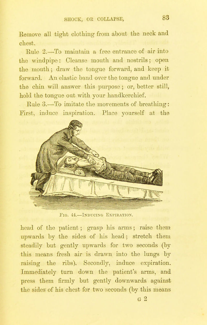 Remove all tiglit clothing from about the neck ancl chest. Rule 2.—To maintain a free entrance of air into tho windpipe: Cleanse mouth and nostrils; open the mouth; draw the tongue forward, and keep it forward. An elastic band over the tongue and under the chin will answer this purpose ; or, better still, hold the tongue out with your handkerchief. Rule 3.-—To imitate the movements of breathing: First, induce inspiration. Place yourself at the Fig. 44.—Inducing Expiration. head of the patient; grasp his arms; raise them upwards by the sides of his head ; stretch them steadily but gently upwards for two seconds (by this means fresh air is drawn into the lungs by raising the ribs). Secondly, induce expiration. Immediately turn down the patient’s arms, and press them firmly but gently downwards against the sides of his chest for two seconds (by this means G 2