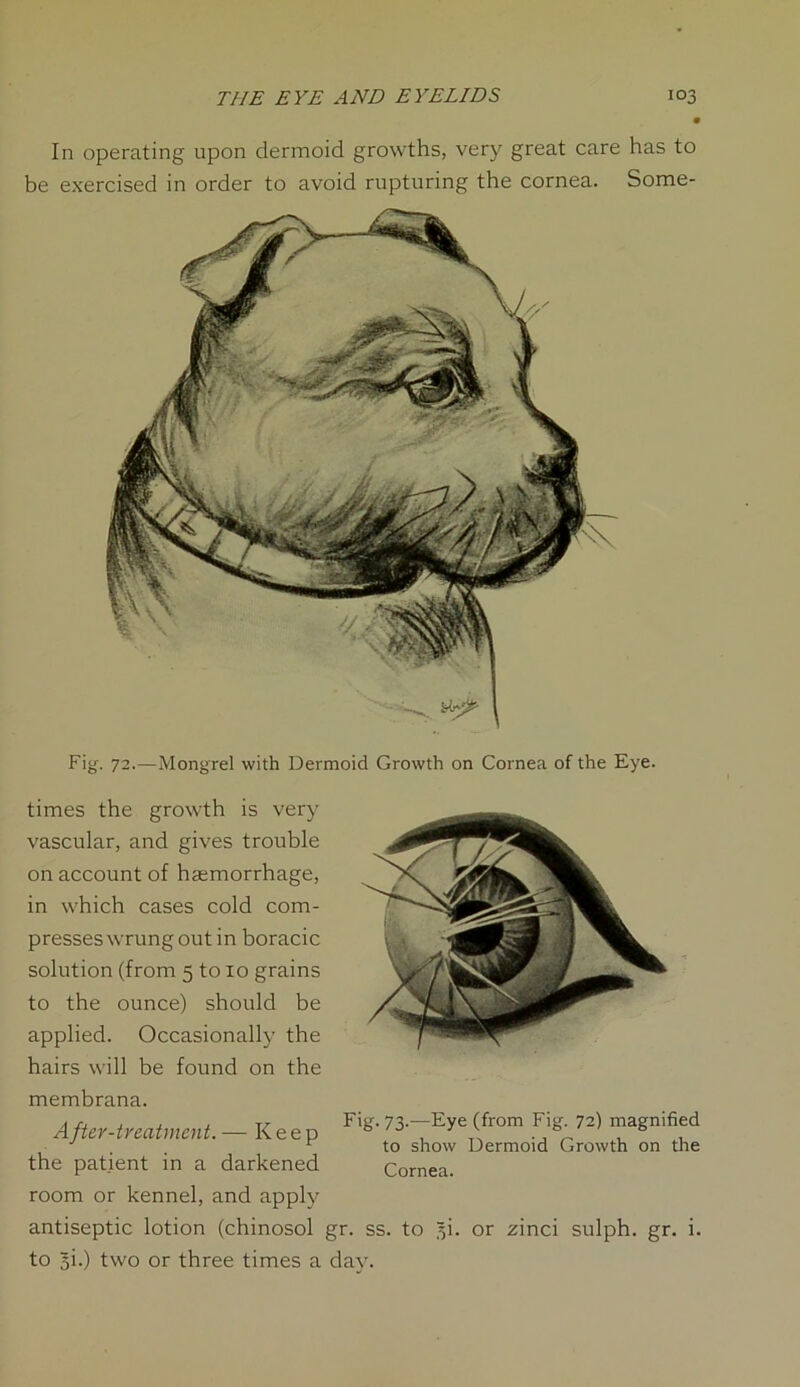 In operating upon dermoid growths, very great care has to be exercised in order to avoid rupturing the cornea. Some- Fig-. 72.—Mongrel with Dermoid Growth on Cornea of the Eye. times the growth is very vascular, and gives trouble on account of hemorrhage, in which cases cold com- presses wrung out in boracic solution (from 5 to 10 grains to the ounce) should be applied. Occasionally the hairs will be found on the membrana. A fter-treatment. — Keep the patient in a darkened room or kennel, and apply F'g- 73-—Eye (from Fig. 72) magnified to show Dermoid Growth on the Cornea. antiseptic lotion (chinosol gr. ss. to 7,i. or zinci sulph. gr. i. to §i.) two or three times a day.