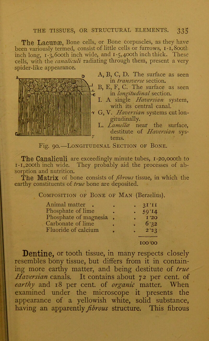 The LaCUnaB, Bone cells, or Bone corpuscles, as they have been variously termed, consist of little cells or furrows, i-i. Sooth inch long, 1-3,600th inch wide, and I-5,400th inch thick. These cells, with the canaliculi radiating through them, present a very spider-like appearance. A, B, C, D. The surface as seen in transverse section. B, E, F, C. The surface as seen in longitudinal section. I. A single Haversian system, with its central canal. G, V. Haversian systems cut lon- gitudinally. L. Lamella near the surface, destitute of Haversian sys- tems. Fig. 90.—Longitudinal Section of Bone. The Canaliculi are exceedingly minute tubes, i-20,000th to I-1,200th inch wide. They probably aid the processes of ab- sorption and nutrition. The Matrix of bone consists of fibrous tissue, in which the earthy constituents of tnie bone are deposited. Composition of Bone of Man (Berzelius). Animal matter . . . 3i'ii Phosphate of lime . . 59'14 Phosphate of magnesia , . i ’20 Carbonate of lime . . 6 '32 Fluoride of calcium . . 2^23 100‘OO Dentine, or tooth tissue, in many respects closely resembles bony tissue, but differs from it in contain- ing more earthy matter, and being destitute of true Haversian canals. It contains about 72 per cent, of earthy and 18 per cent, of organic matter. When examined under the microscope it presents the appearance of a yellowish white, solid substance, having an apparently fibrous structure. This fibrous