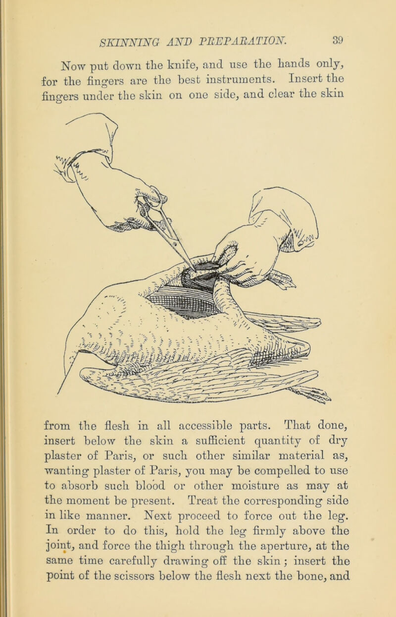 Now put down tlie knife, and use the hands only, for the fingers are the best instruments. Insert the fingers under the skin on one side, and clear the skin from the flesh in all accessible parts. That done, insert below the skin a sufficient quantity of dry plaster of Paris, or such other similar material as, wanting plaster of Paris, you may be compelled to use to absorb such blood or other moisture as may at the moment be present. Treat the corresponding side in like manner. Next proceed to force out the leg. In order to do this, hold the leg firmly above the joint, and force the thigh through the aperture, at the same time carefully drawing off the skin ; insert the point of the scissors below the flesh next the bone, and
