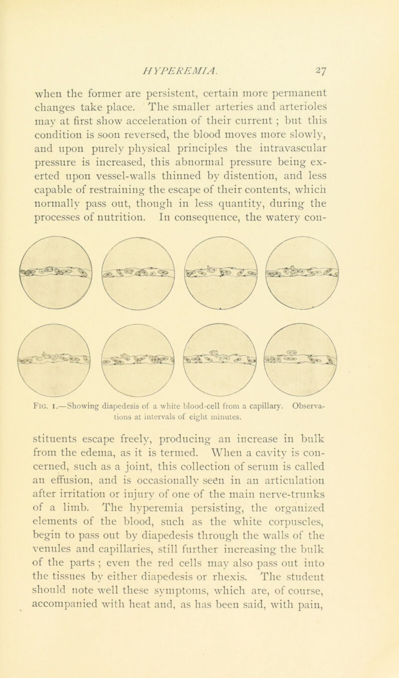 when the former are persistent, certain more permanent changes take place. The smaller arteries and arterioles may at first show acceleration of their current ; iDiit this condition is soon reversed, the blood moves more slowly, and upon purely physical principles the intravascular pressure is increased, this abnormal pressure being ex- erted upon vessel-walls thinned by distention, and le.ss capable of restraining the escape of their contents, which normally pass out, though in less quantity, during the processes of nutrition. In consequence, the watery con- Fig. I.—Showing diapedesis of a white blood-cell from a capillary. Observa- tions at intervals of eight minutes. stitnents escape freely, producing an increase in bulk from the edema, as it is termed. When a cavity is con- cerned, such as a joint, this collection of serum is called an effusion, and is occasionally seOii in an articulation after irritation or injury of one of the main nerve-trunks of a limb. The hyperemia persisting, the organized elements of the blood, such as the white corpuscles, begin to pass out by diapedesis through the walls of the venules and capillaries, still further increasing the bulk of the parts ; even the red cells may also pass out into tlie tissues by either diapedesis or rhexi.s. The student should note well these symptoms, which are, of course, accompanied with heat and, as has been said, with pain.