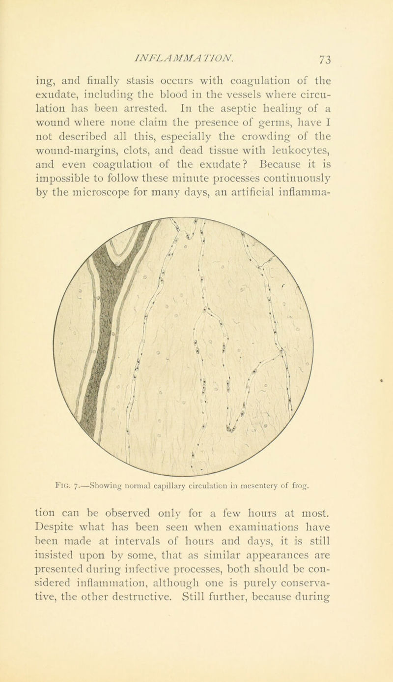 ing, and finally stasis occurs with coagulation of the exudate, including the blood in the vessels where circu- lation has been arrested. In the aseptic healing of a wound where none claim the presence of germs, have I not described all this, especially the crowding of the wound-margins, clots, and dead tissue with leukocytes, and even coagulation of the exudate? Because it is impossible to follow these minute processes continuously by the microscope for many days, an artificial inflamma- tion can be observed only for a few hours at most. Despite what has been seen when examinations have been made at intervals of hours and days, it is still insisted upon by some, that as similar appearances are presented during infective processes, both should be con- sidered inflammation, although one is purely conserva- tive, the other destructive. Still further, because during