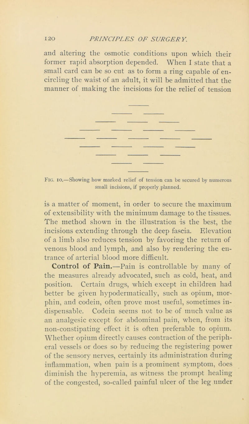 and altering the osmotic conditions upon which their former rapid absorption depended. When I state that a small card can be so cnt as to form a ring capable of en- circling the waist of an adult, it will be admitted that the manner of making the incisions for the relief of tension Fig. io.—Showing how marked relief of tension can be secured by numerous small incisions, if properly planned. is a matter of moment, in order to secure the maximum of extensibility with the minimum damage to the tissues. The method shown in the illustration is the best, the incisions extending through the deep fascia. Elevation of a limb also reduces tension by favoring the return of venous blood and lymph, and also by rendering the en- trance of arterial blood more difficult. Control of Pain.—Pain is controllable by many of the measures already advocated, such as cold, heat, and position. Certain drugs, which except in children had better be given hypodennatically, such as opium, mor- phin, and codein, often prove most useful, sometimes in- dispensable. Codein seems not to be of much value as an analgesic except for abdominal pain, when, from its uon-constipating effect it is often preferable to opium. Whether opium directly causes contraction of the periph- eral vessels or does so by reducing the registering power of the sensory nerves, certainly its administration during inflammation, when pain is a prominent symptom, does diminish the hyperemia, as witness the prompt healing of the congested, so-called painful ulcer of the leg under
